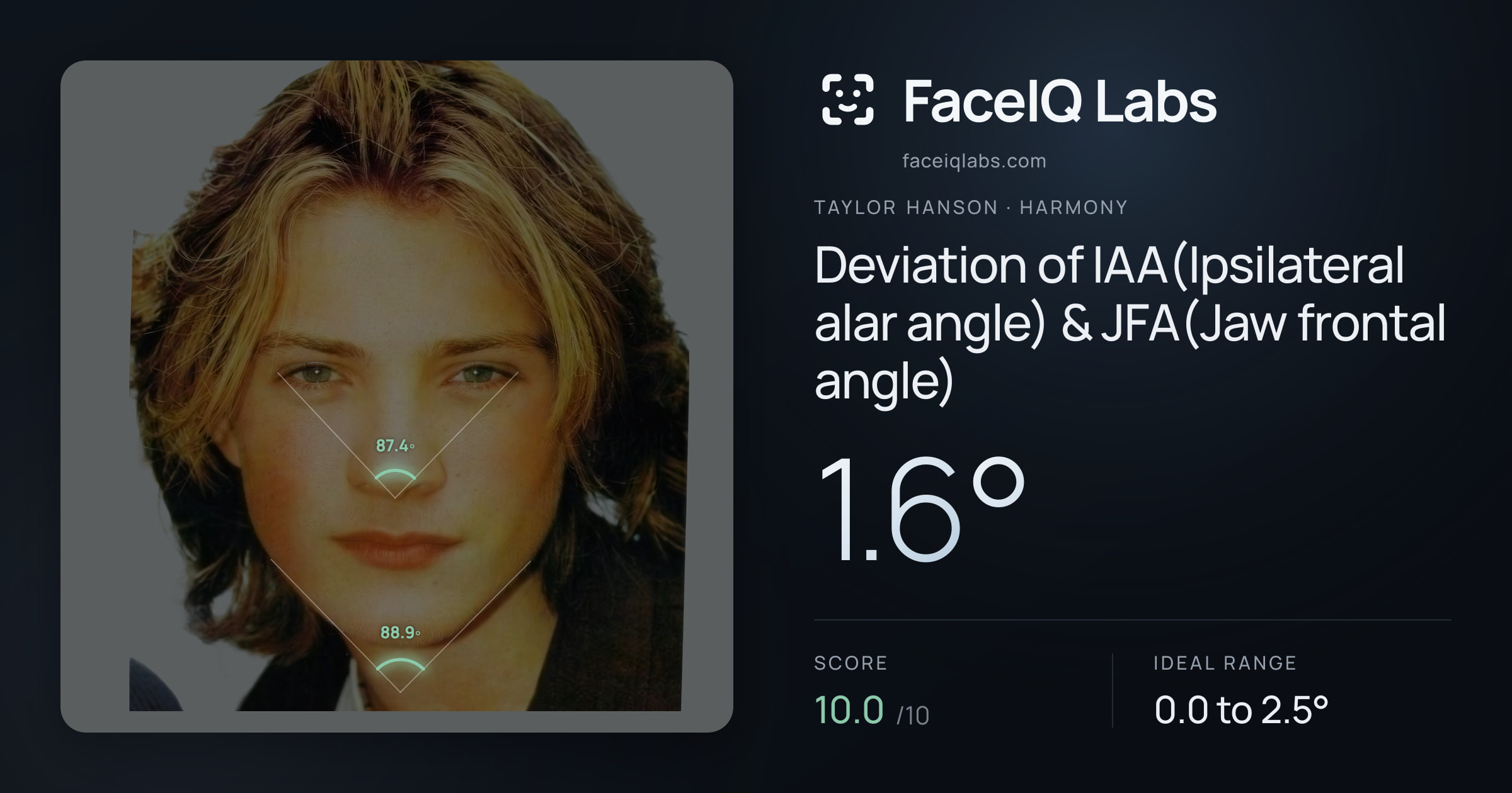 Taylor Hanson Deviation of IAA(Ipsilateral alar angle) & JFA(Jaw frontal angle): 1.6°, drawn on the photo