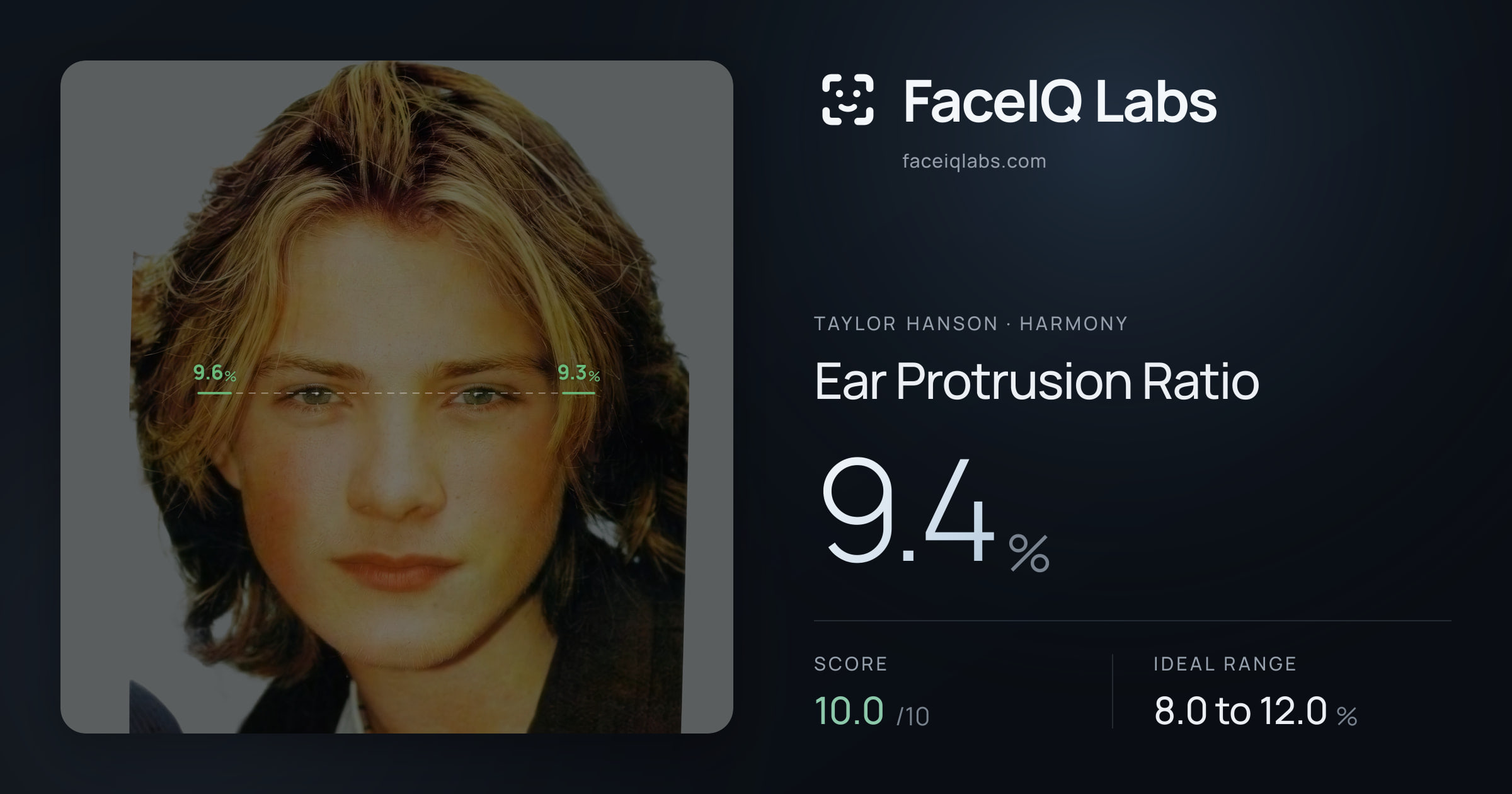 Taylor Hanson Ear Protrusion Ratio: 9.4%, drawn on the photo