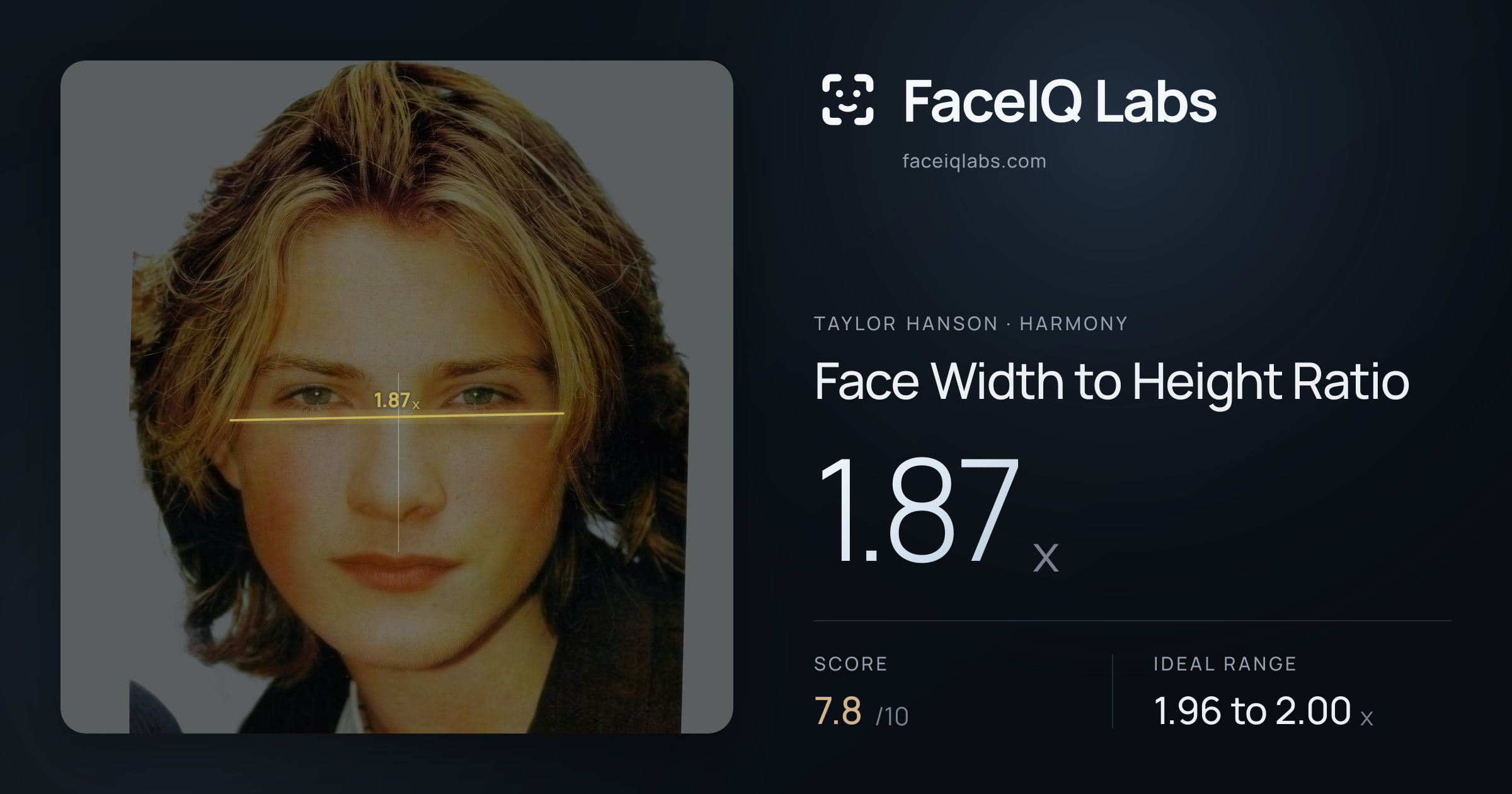 Taylor Hanson Face Width to Height Ratio: 1.87x, drawn on the photo