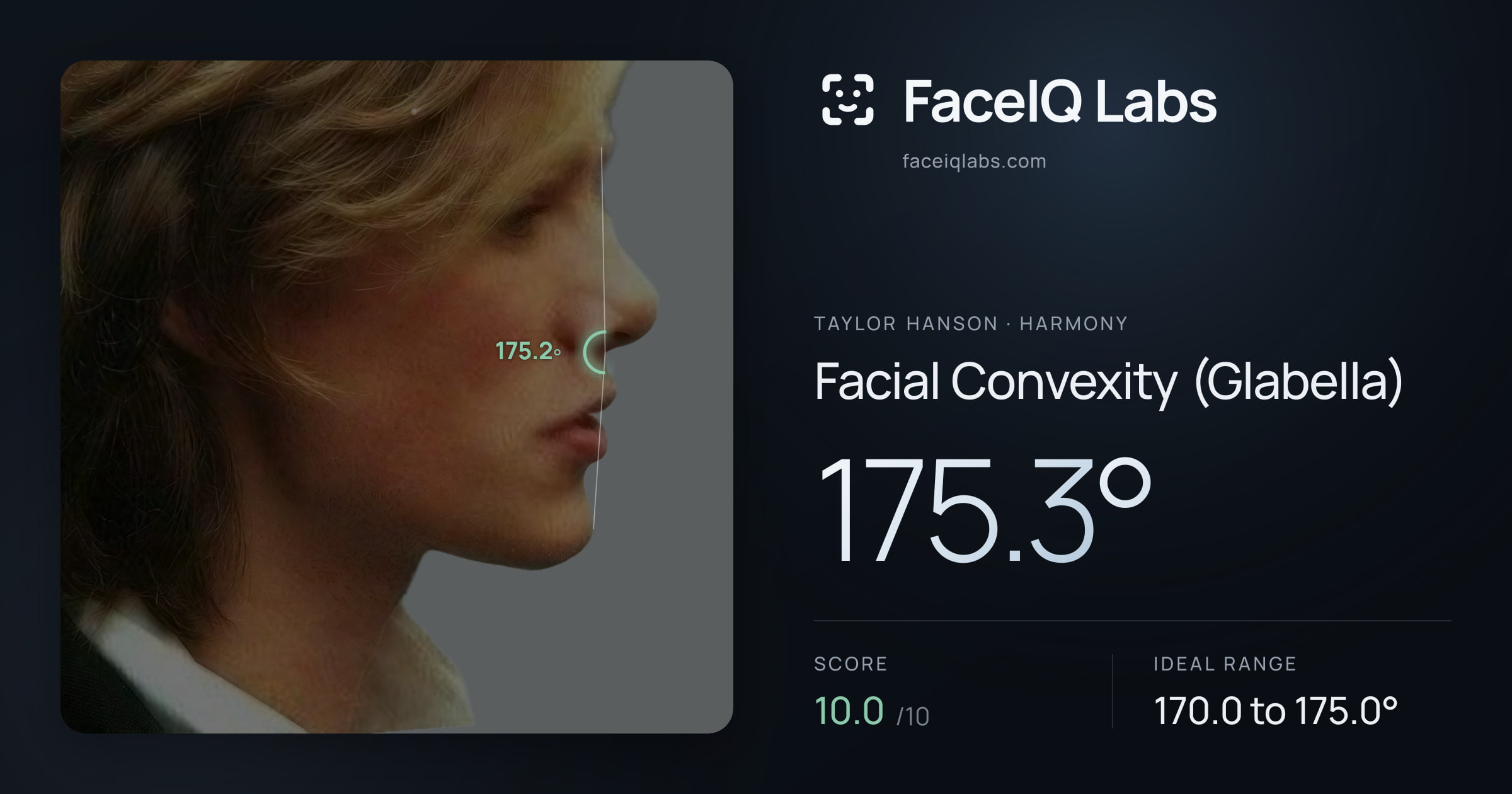 Taylor Hanson Facial Convexity (Glabella): 175.3°, drawn on the photo