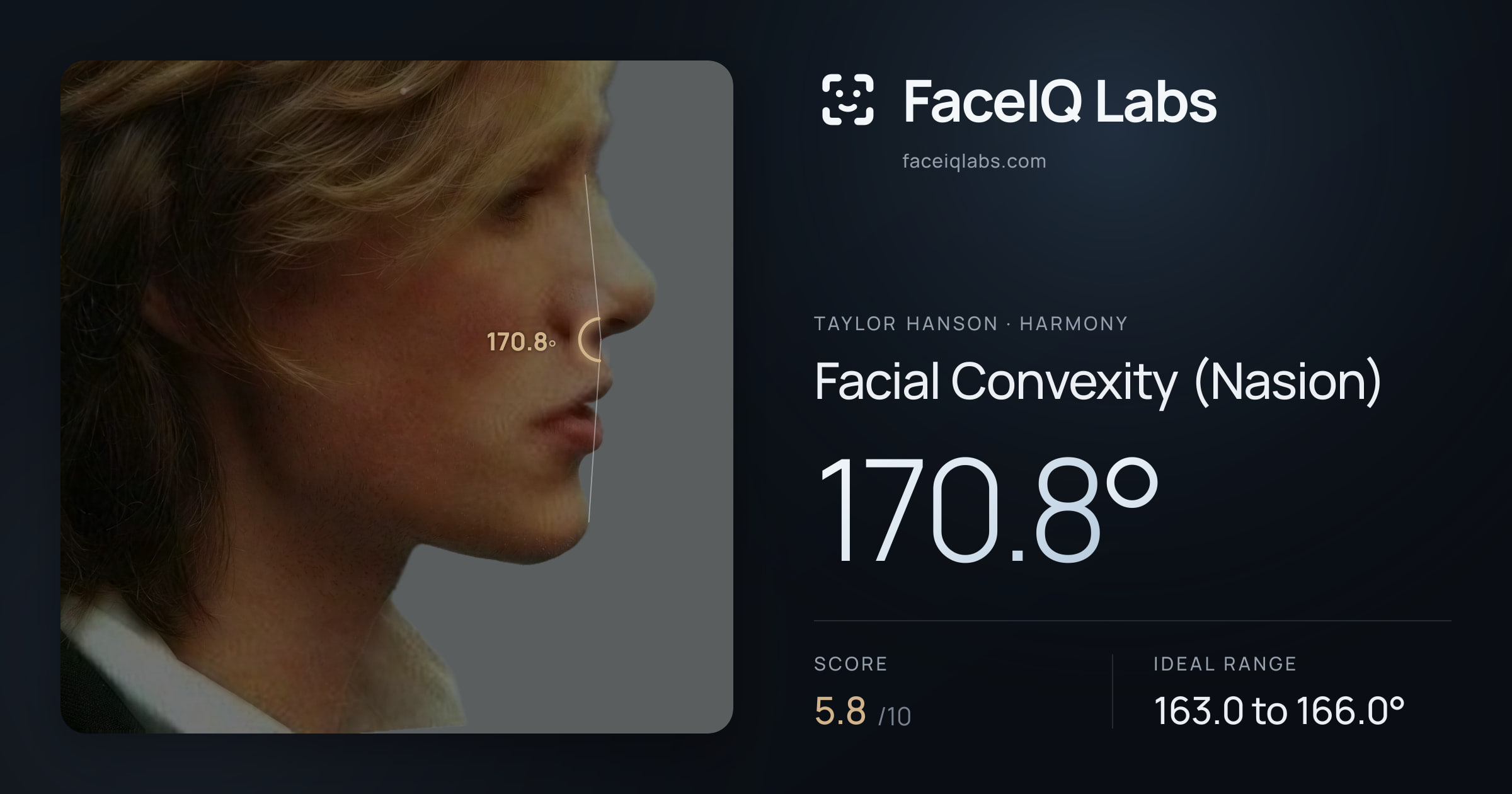 Taylor Hanson Facial Convexity (Nasion): 170.8°, drawn on the photo