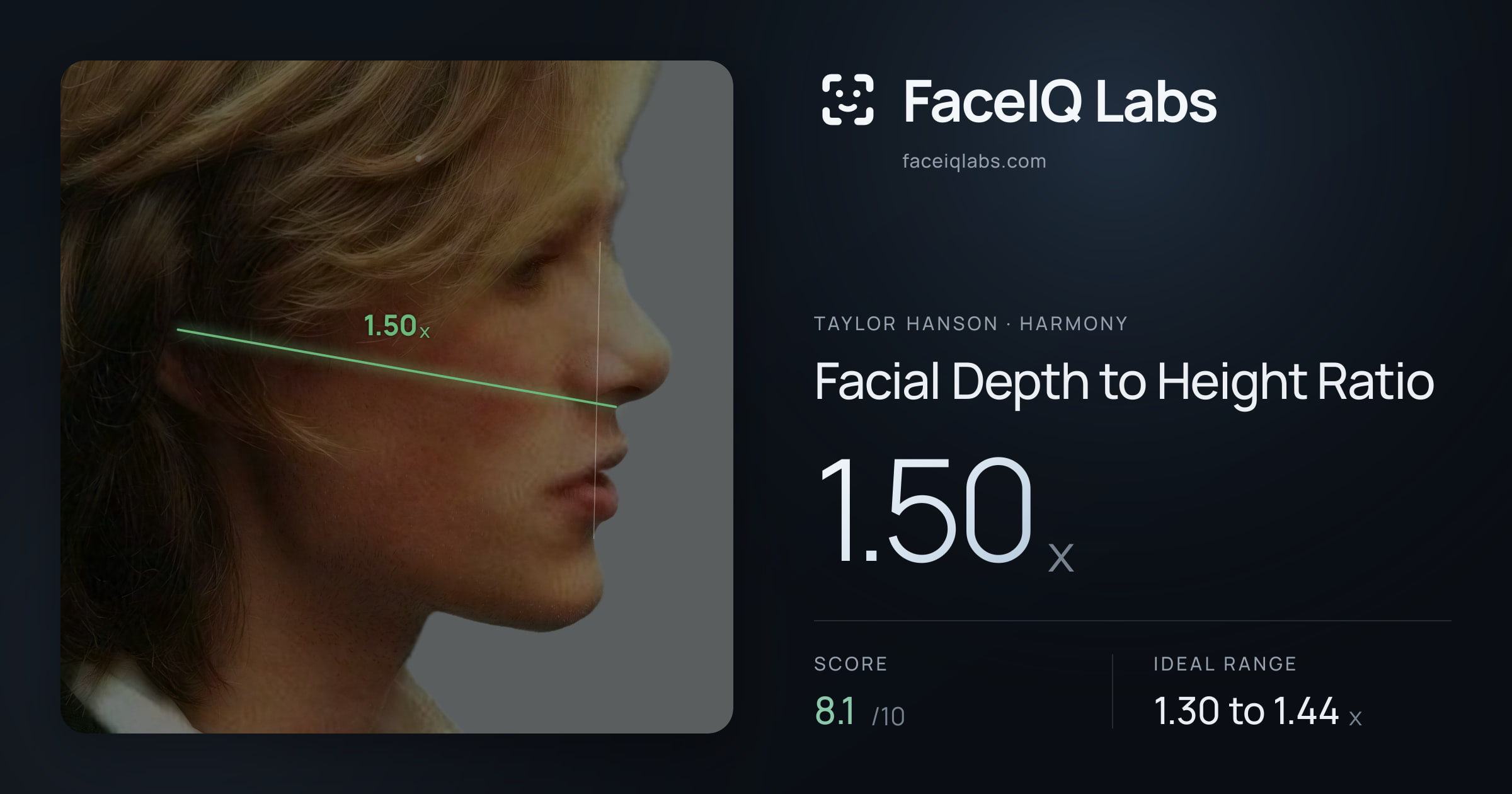 Taylor Hanson Facial Depth to Height Ratio: 1.50x, drawn on the photo