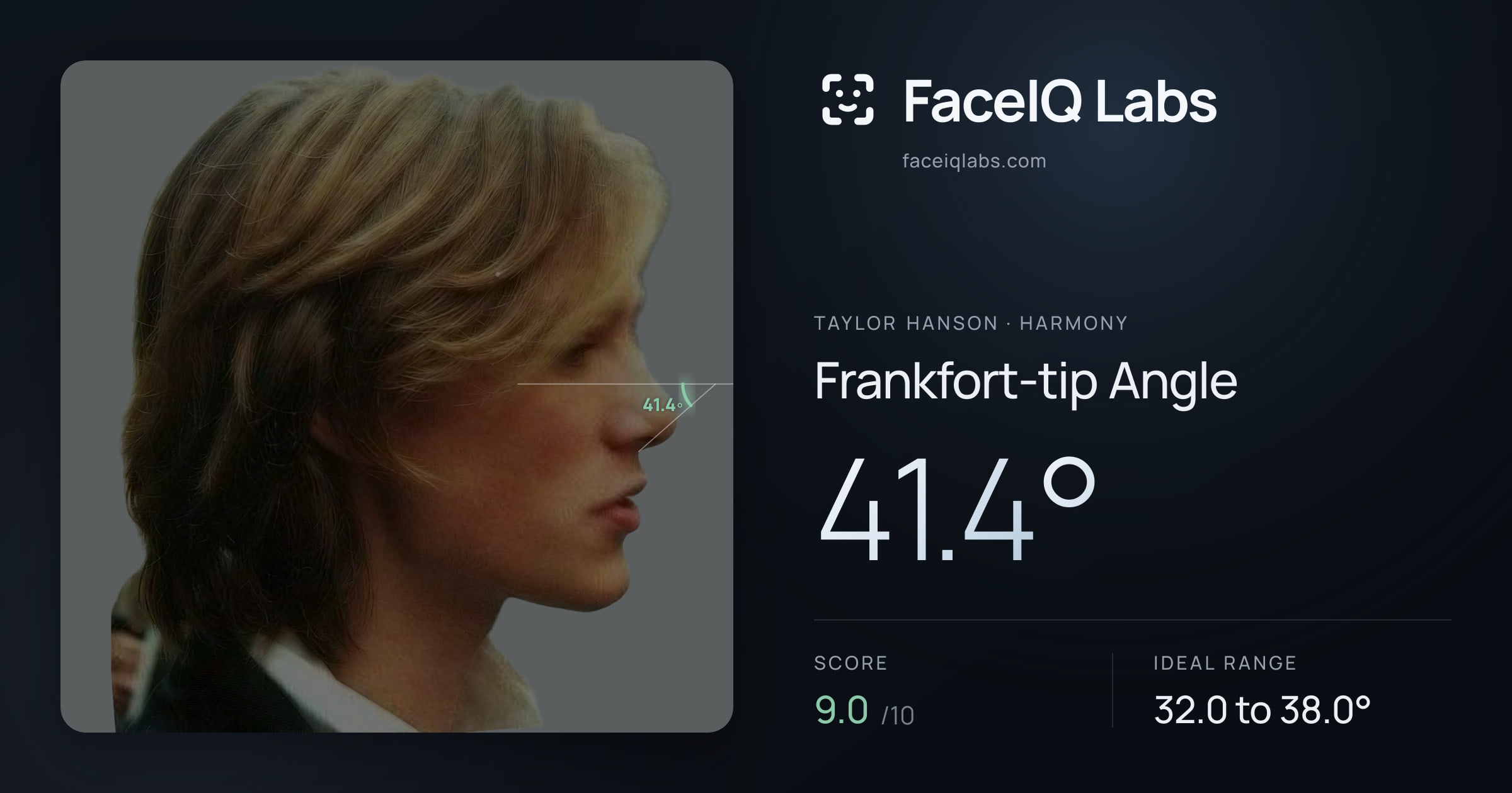 Taylor Hanson Frankfort-tip Angle: 41.4°, drawn on the photo