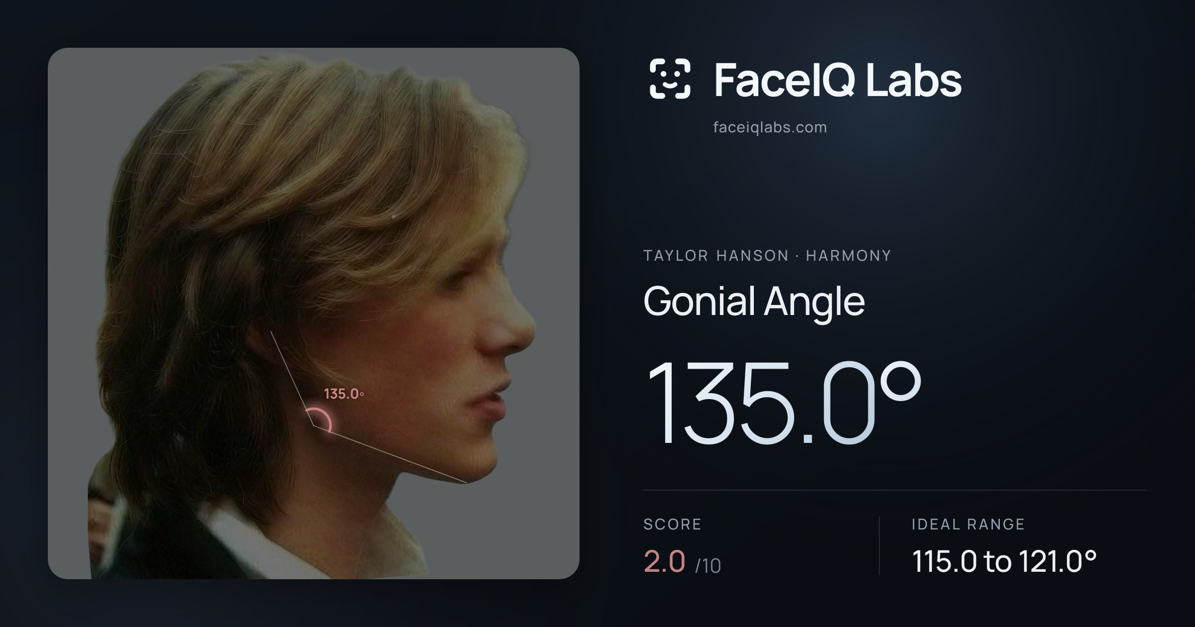 Taylor Hanson Gonial Angle: 135.0°, drawn on the photo