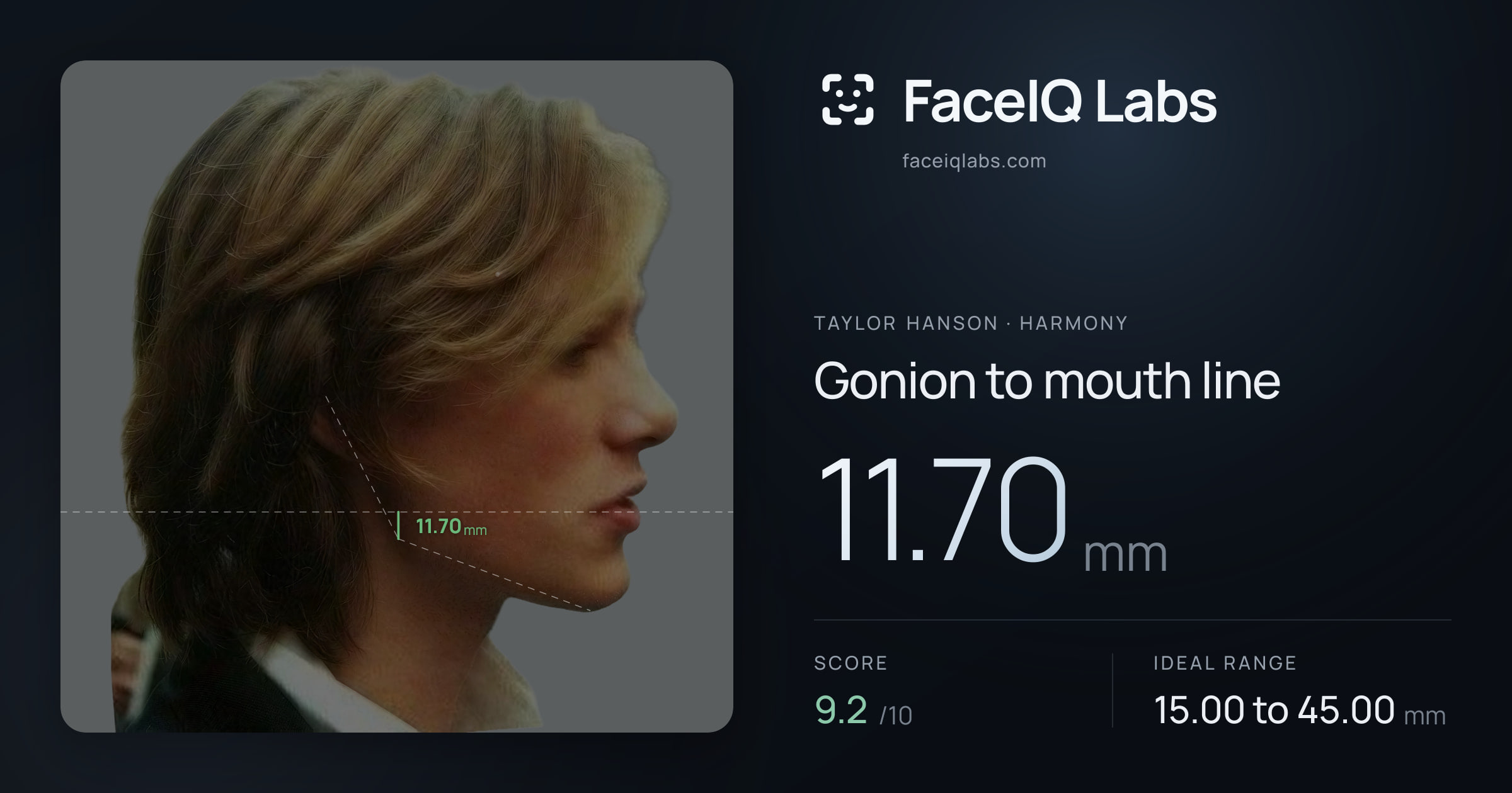 Taylor Hanson Gonion to mouth line: 11.70mm, drawn on the photo