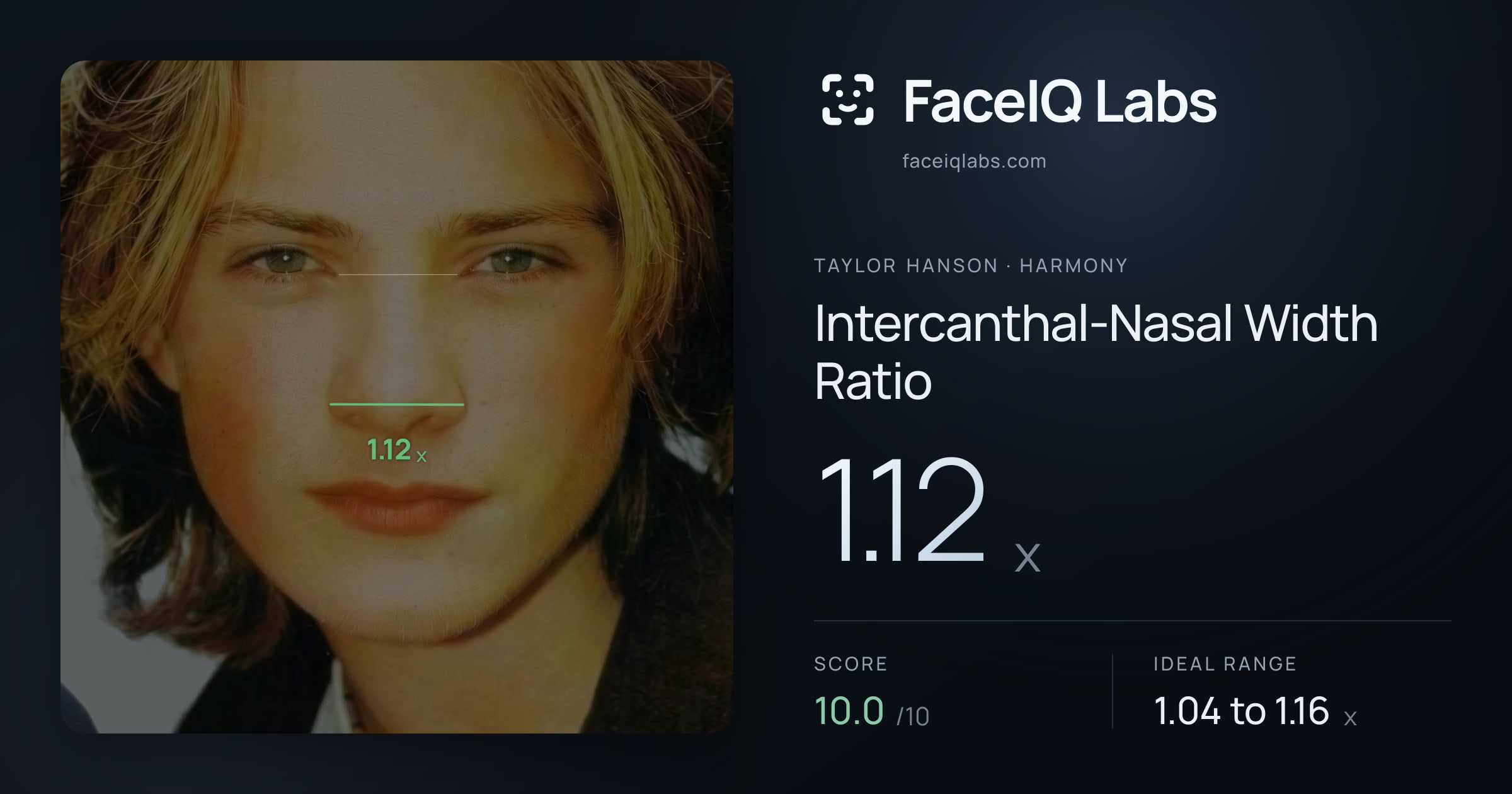 Taylor Hanson Intercanthal-Nasal Width Ratio: 1.12x, drawn on the photo