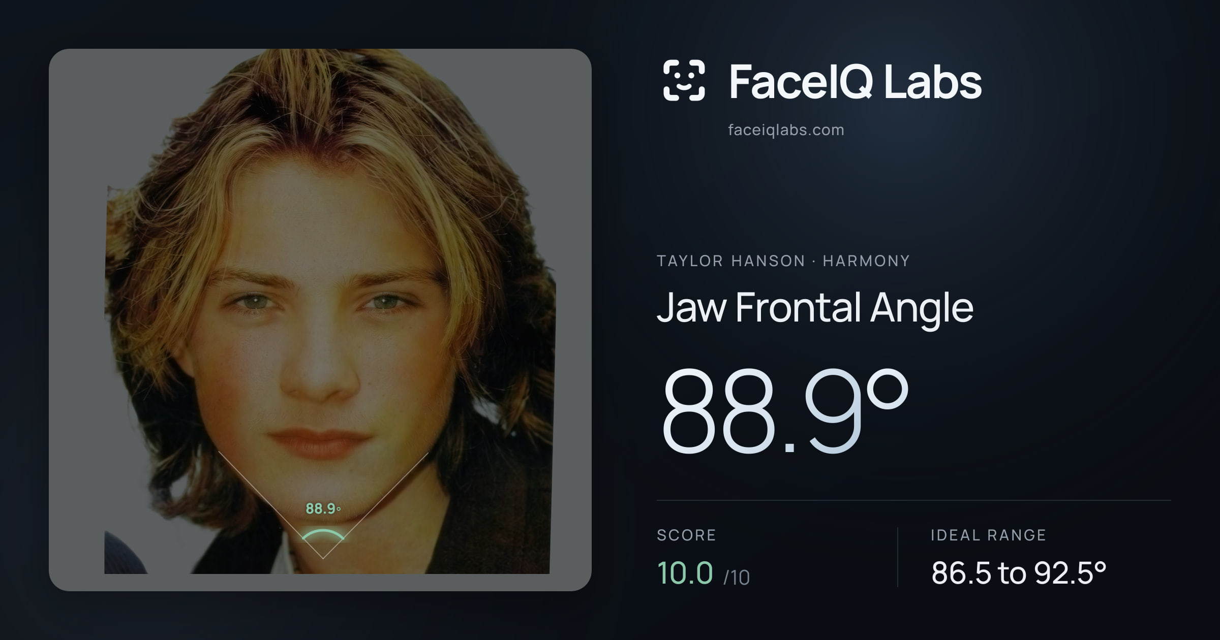 Taylor Hanson Jaw Frontal Angle: 88.9°, drawn on the photo