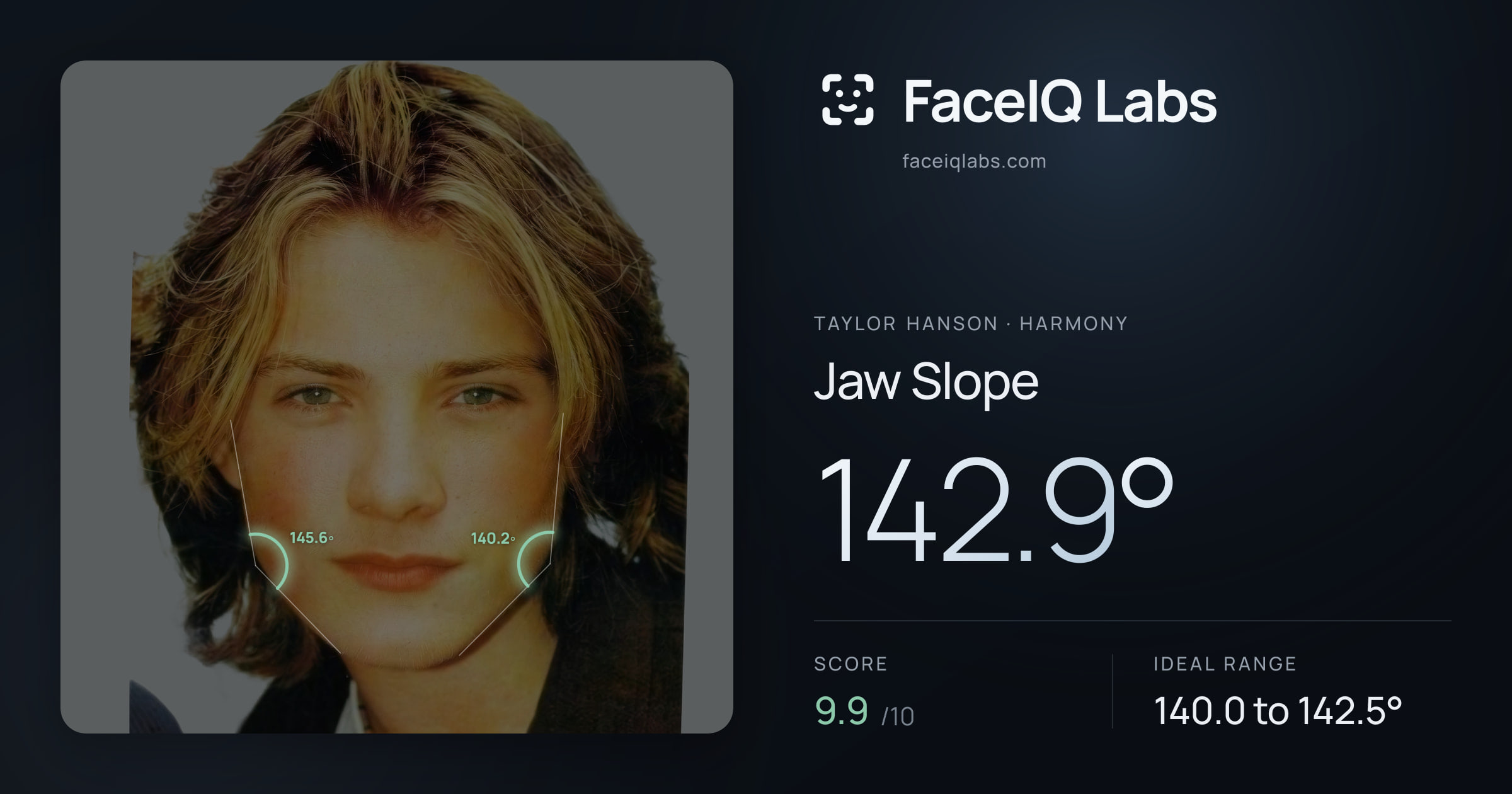 Taylor Hanson Jaw Slope: 142.9°, drawn on the photo