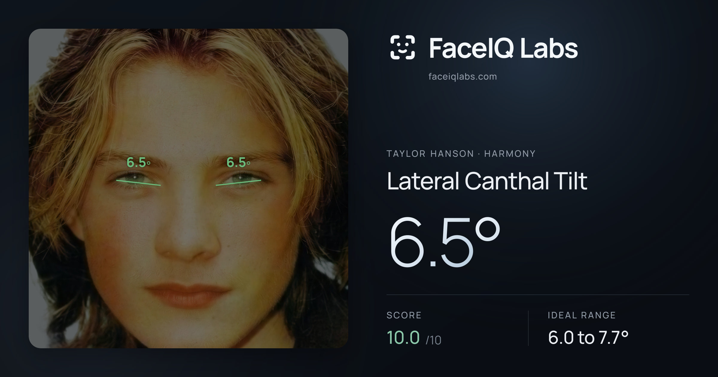 Taylor Hanson Lateral Canthal Tilt: 6.5°, drawn on the photo