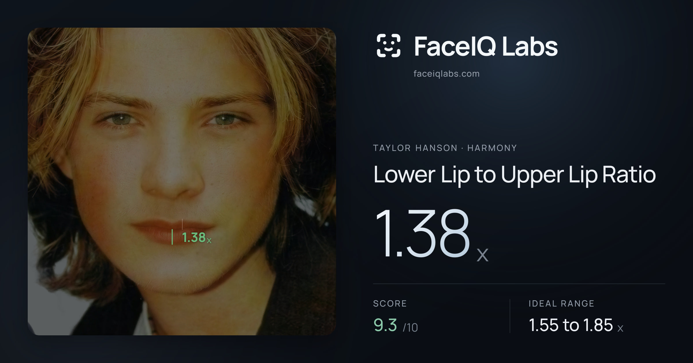 Taylor Hanson Lower Lip to Upper Lip Ratio: 1.38x, drawn on the photo
