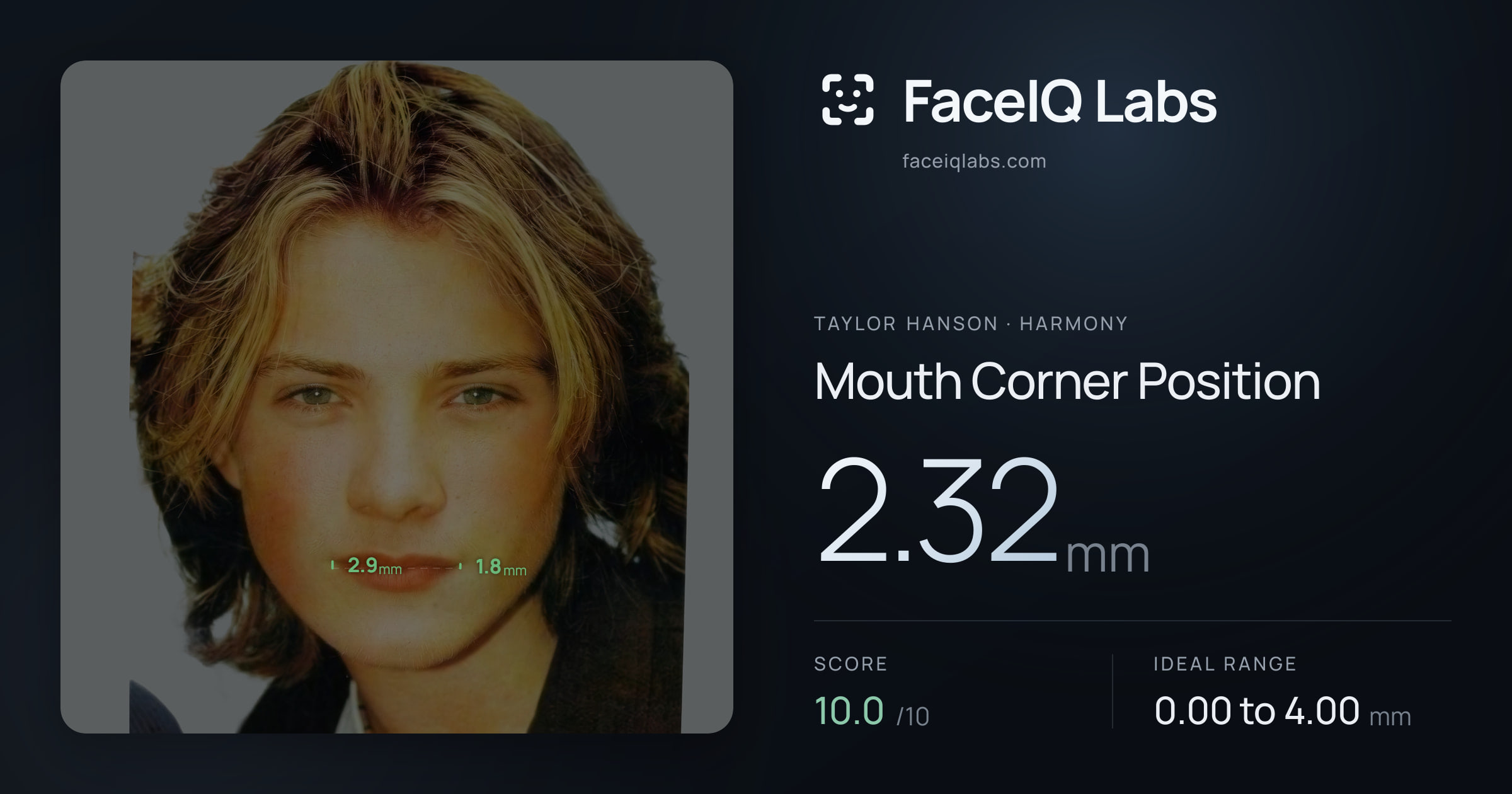 Taylor Hanson Mouth Corner Position: 2.32mm, drawn on the photo