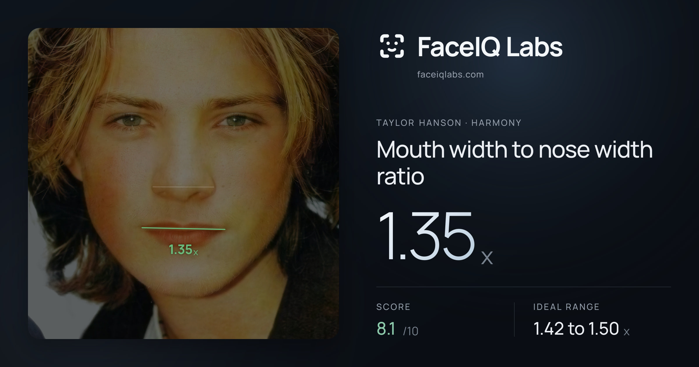 Taylor Hanson Mouth width to nose width ratio: 1.35x, drawn on the photo