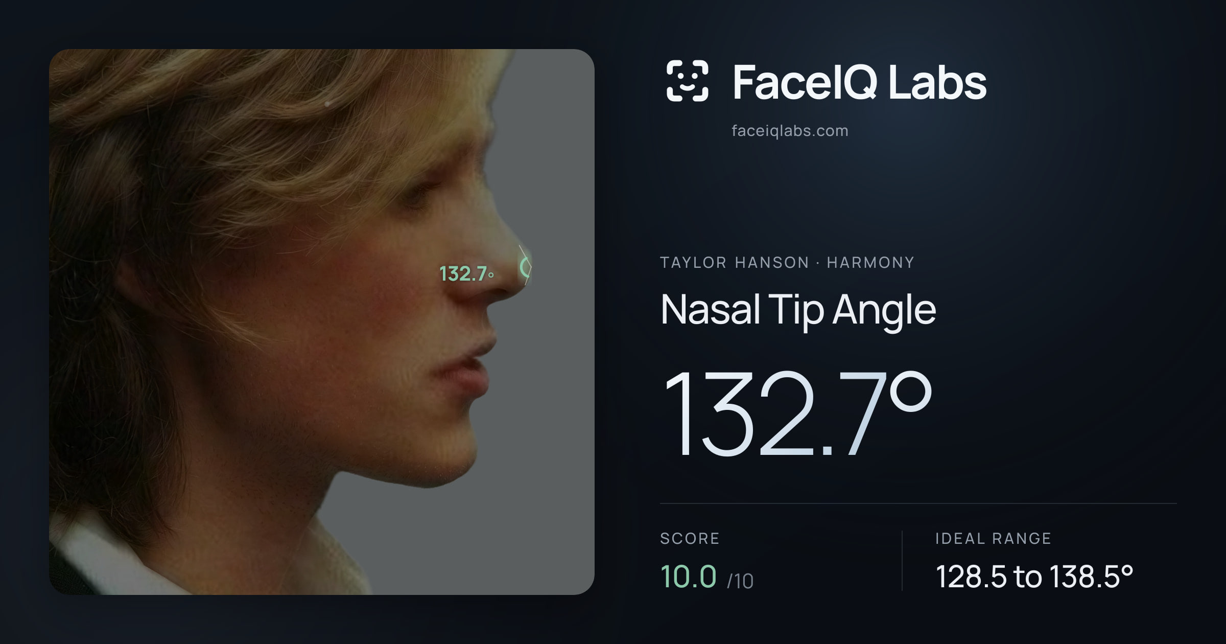 Taylor Hanson Nasal Tip Angle: 132.7°, drawn on the photo