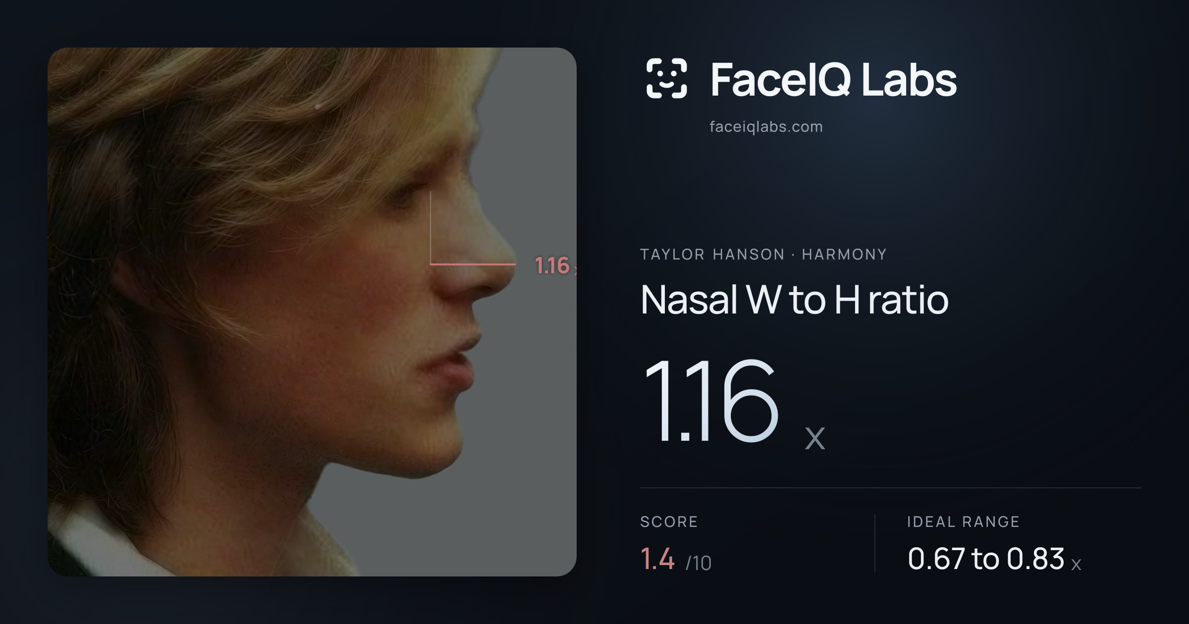 Taylor Hanson Nasal W to H ratio: 1.16x, drawn on the photo