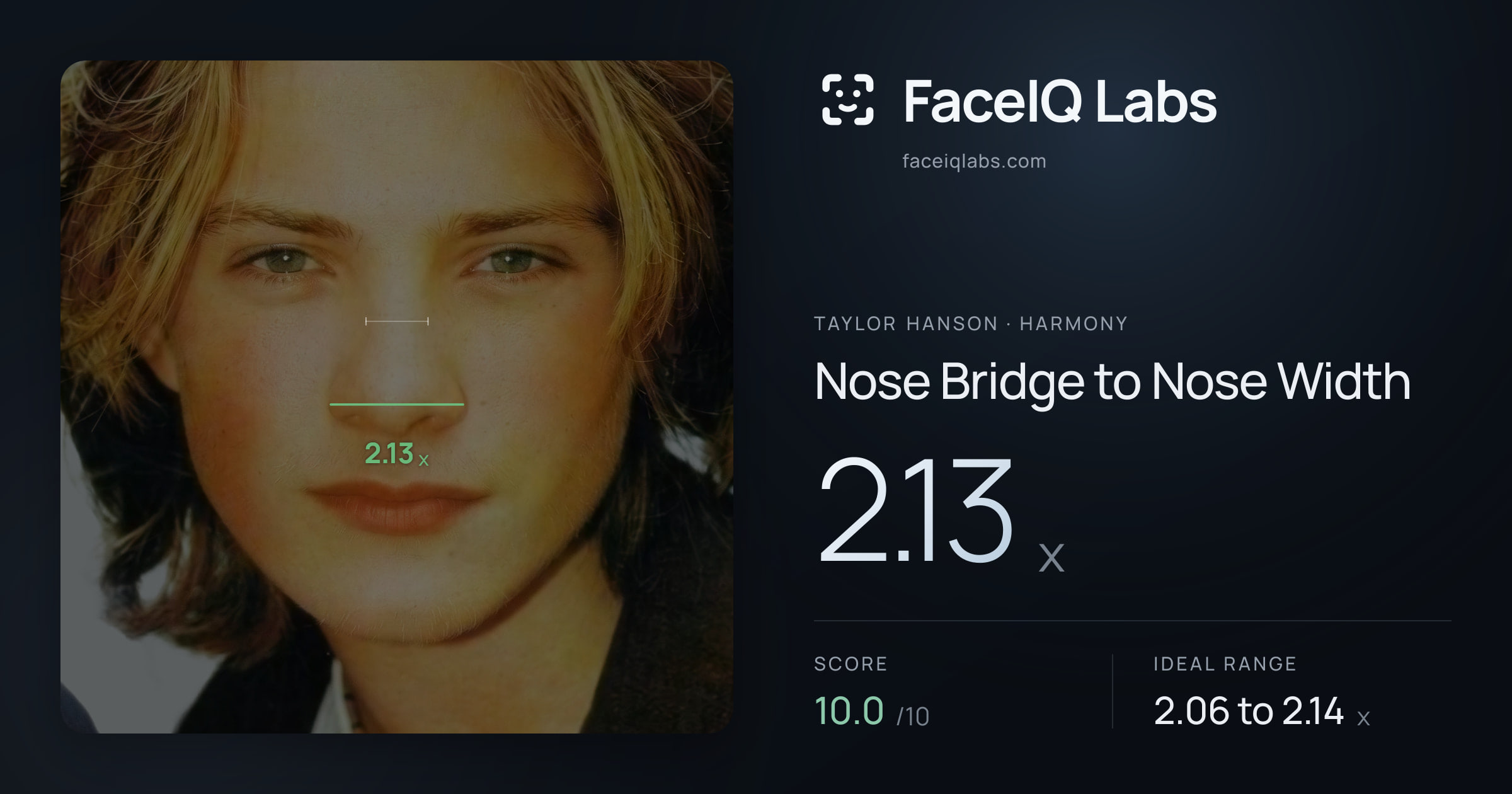 Taylor Hanson Nose Bridge to Nose Width: 2.13x, drawn on the photo