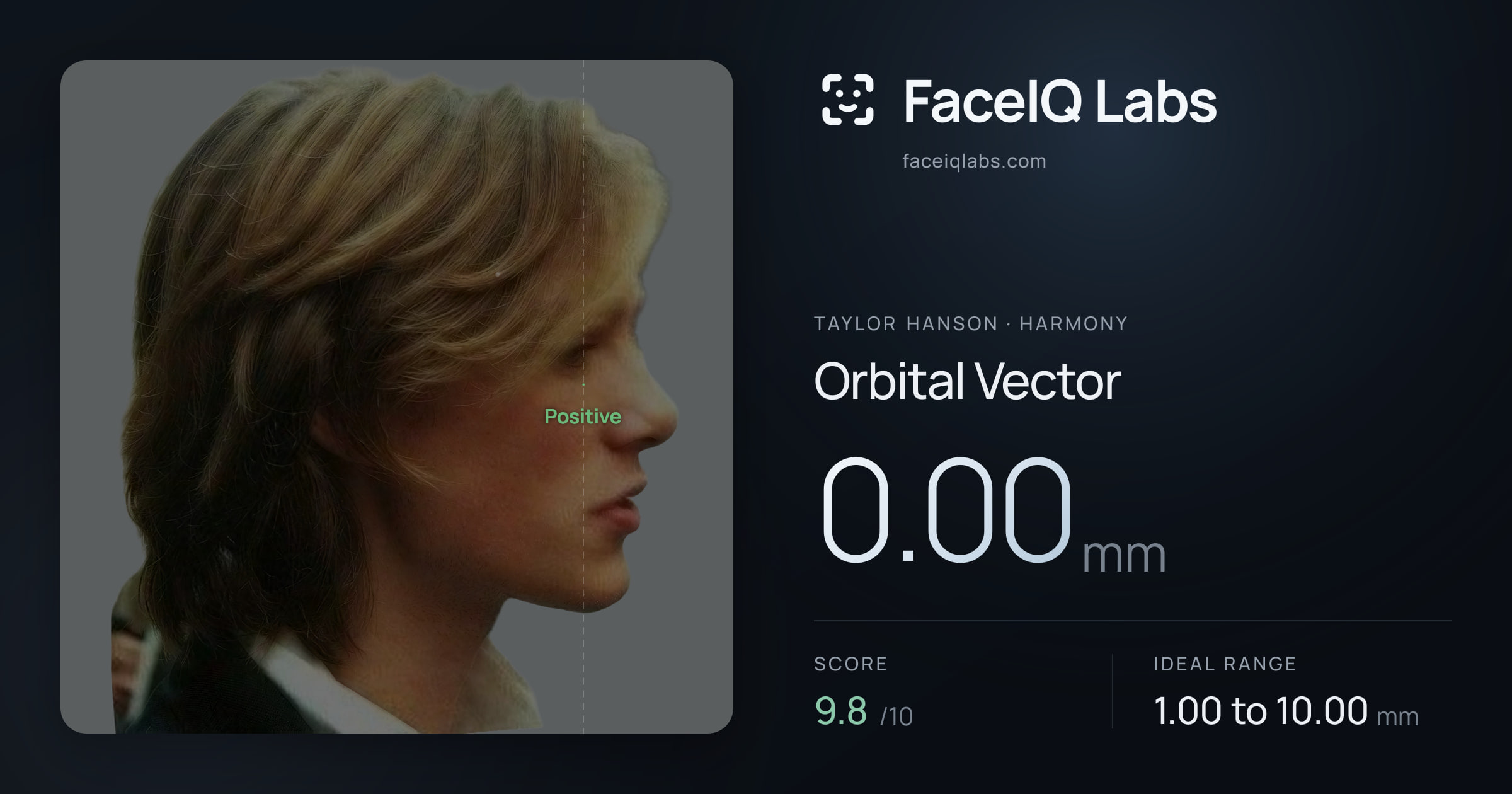 Taylor Hanson Orbital Vector: 0.00mm, drawn on the photo