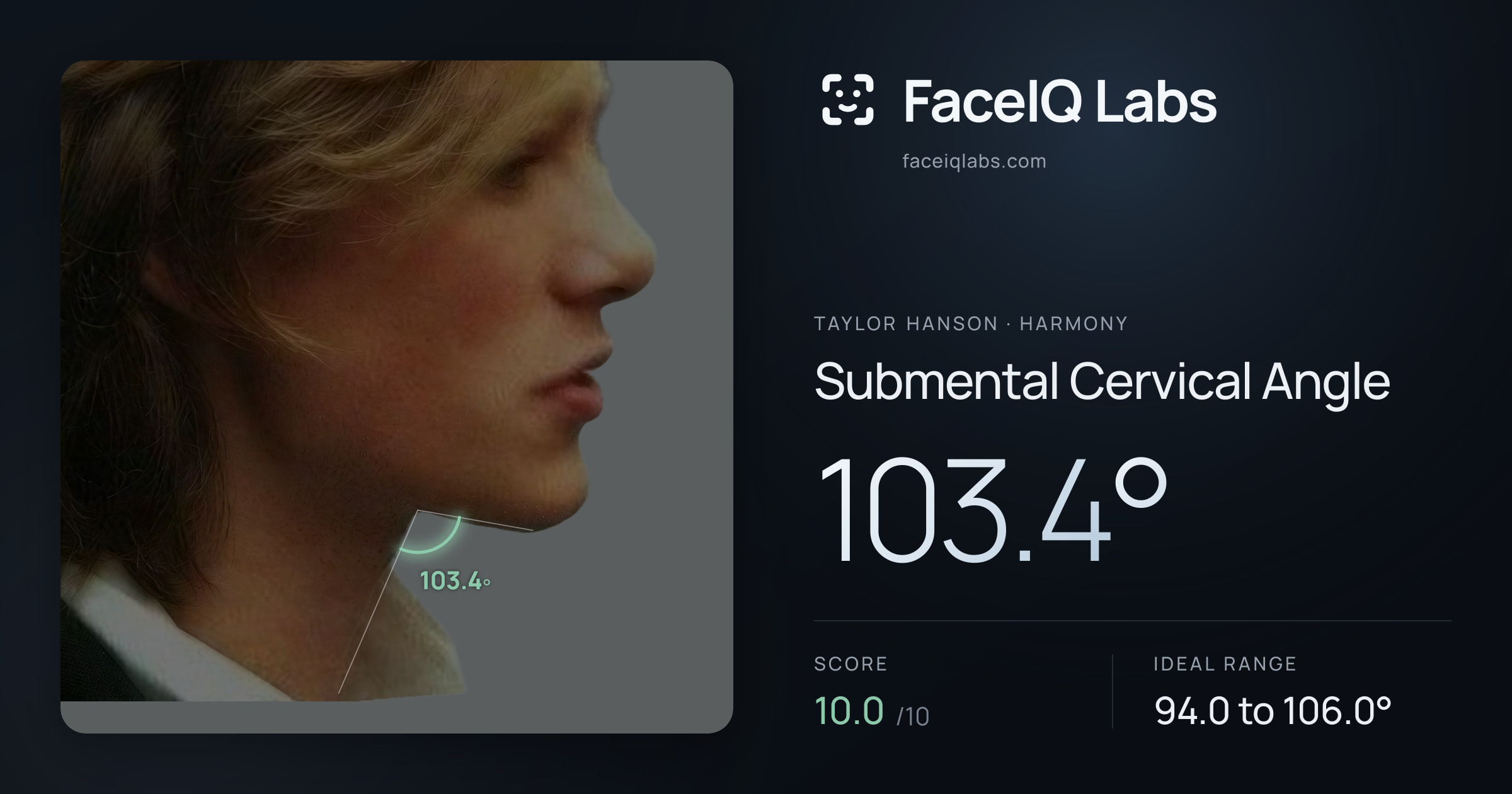 Taylor Hanson Submental Cervical Angle: 103.4°, drawn on the photo