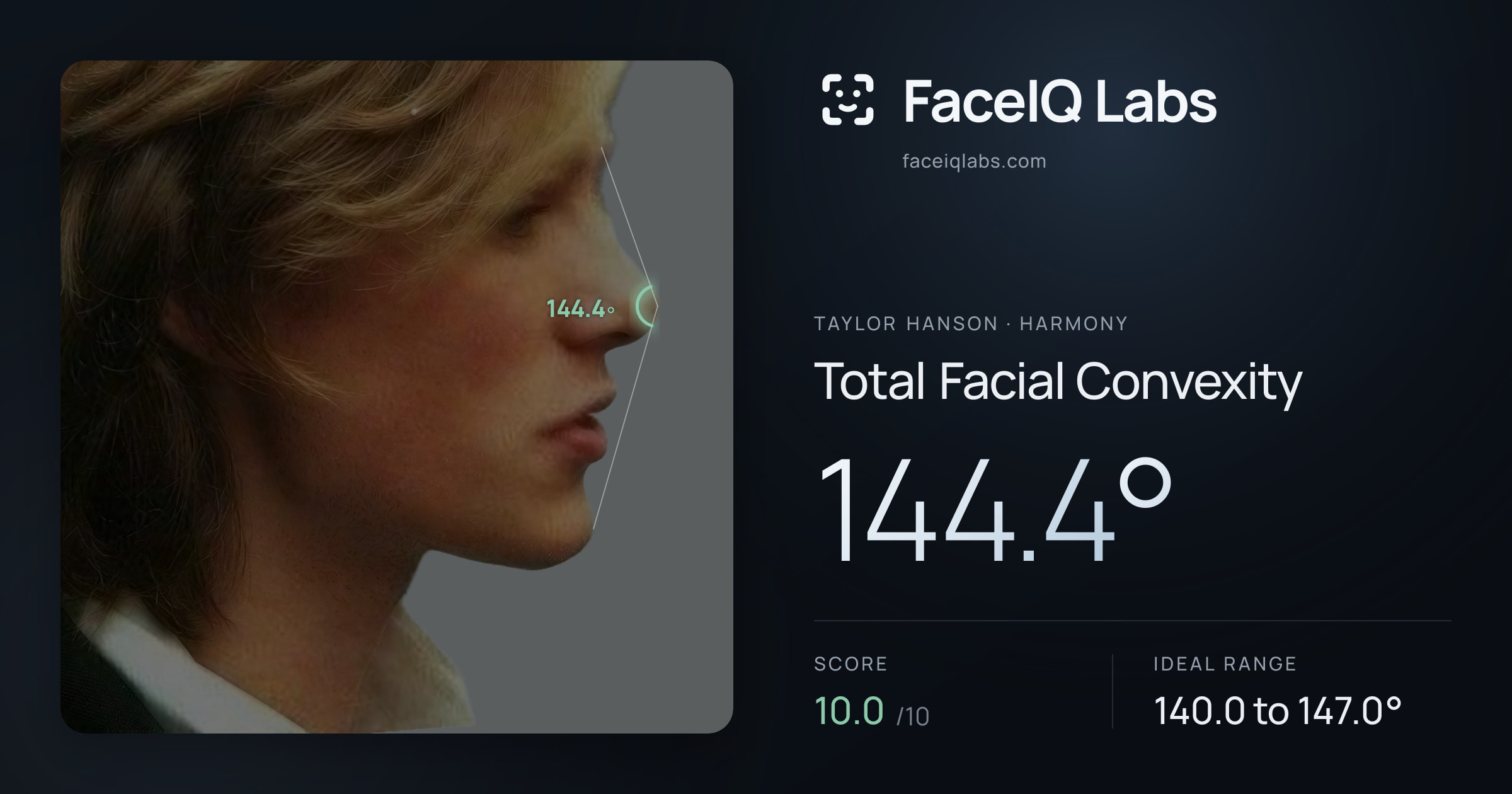 Taylor Hanson Total Facial Convexity: 144.4°, drawn on the photo