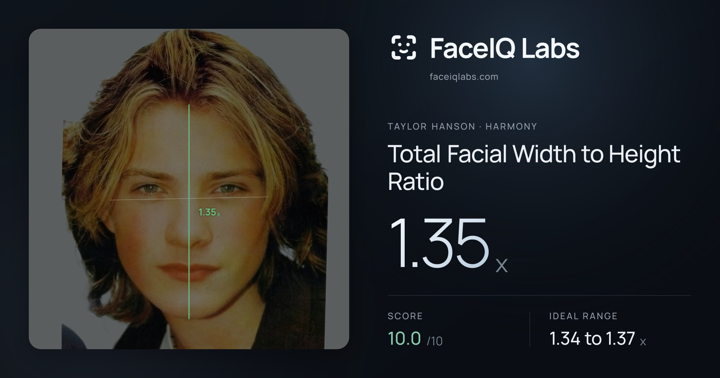 Taylor Hanson Total Facial Width to Height Ratio: 1.35x, drawn on the photo