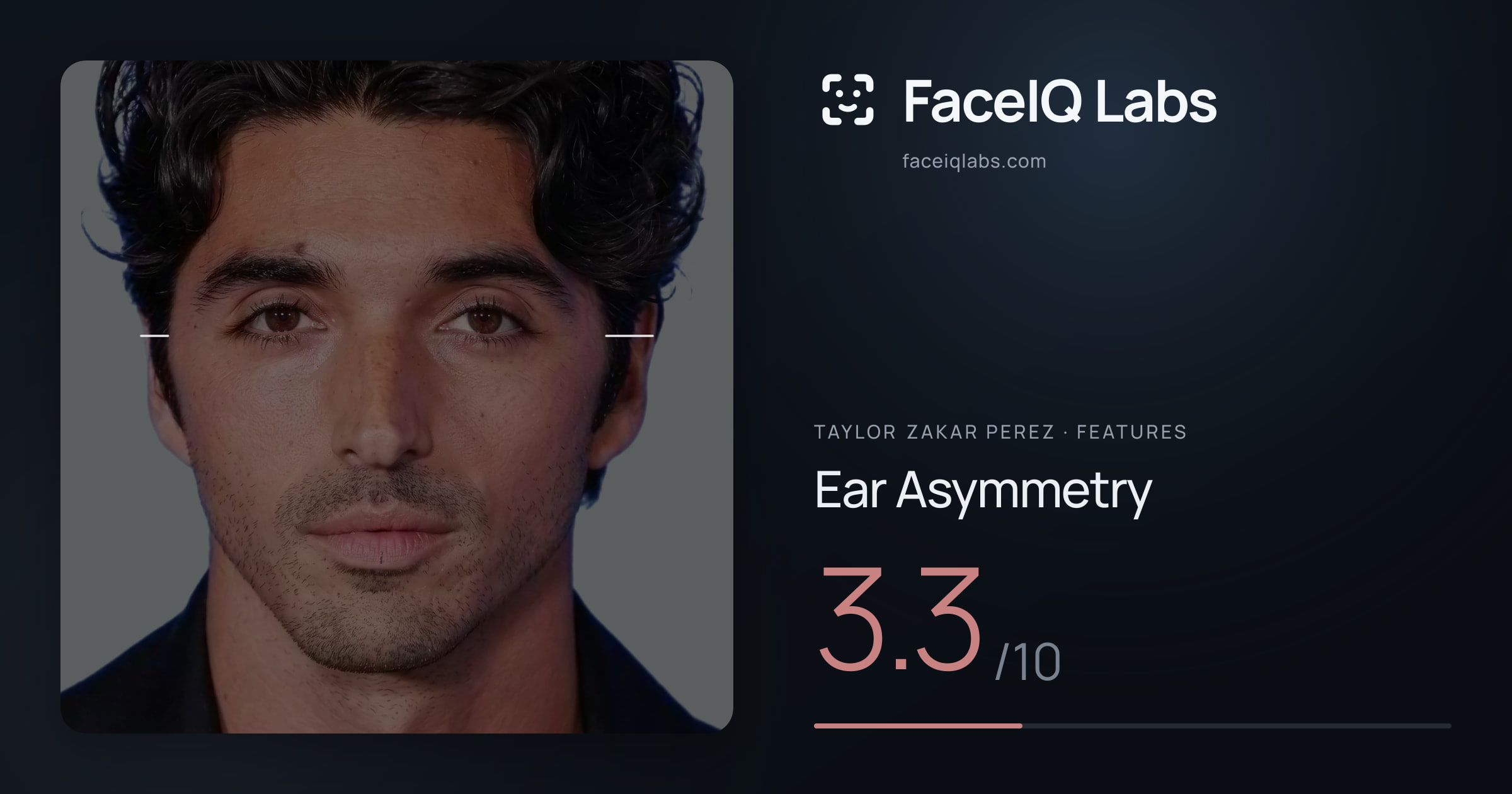Taylor Zakar Perez Ear Asymmetry: 3.3/10, drawn on the photo