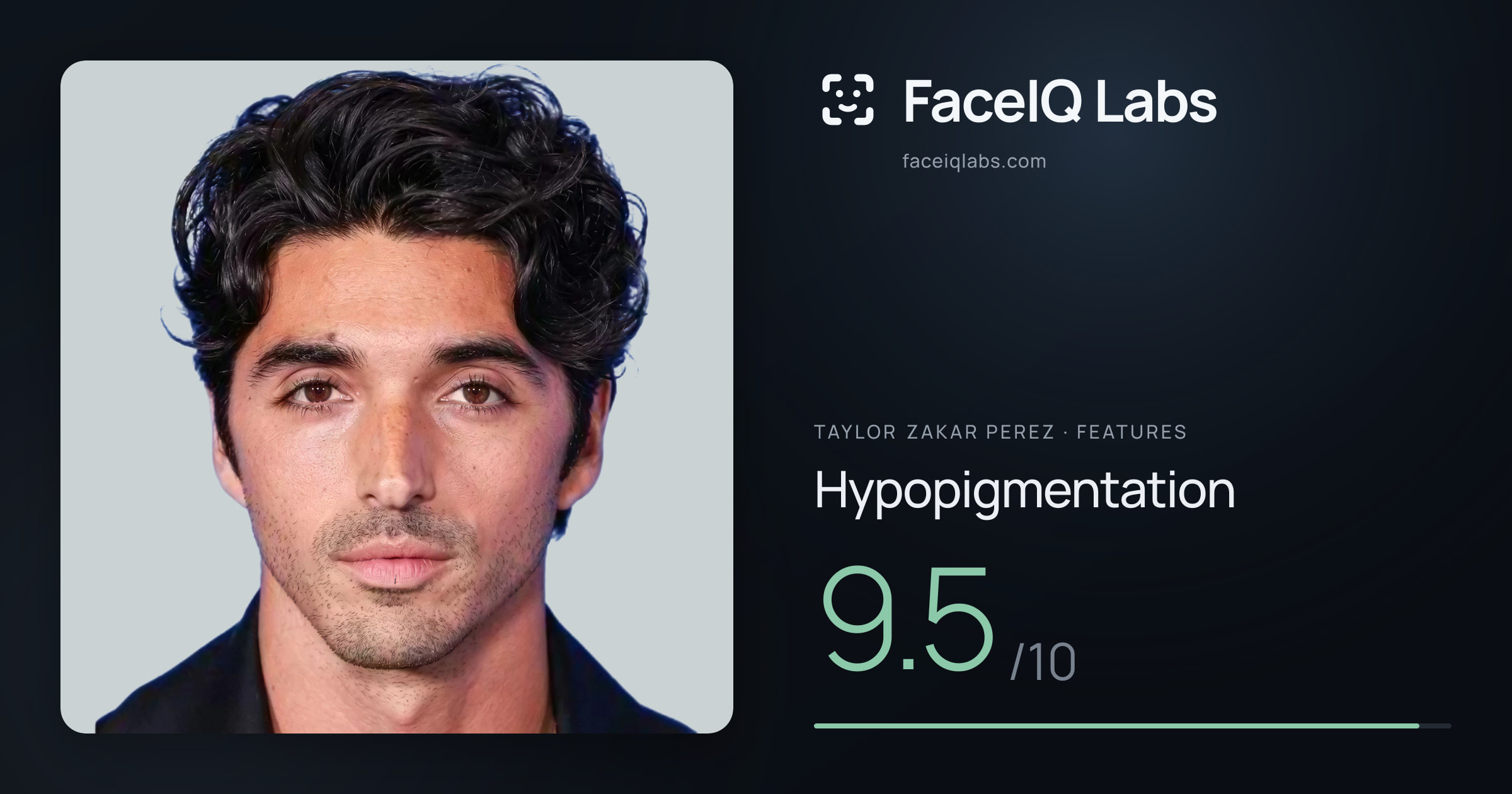 Taylor Zakar Perez Hypopigmentation: 9.5/10, drawn on the photo