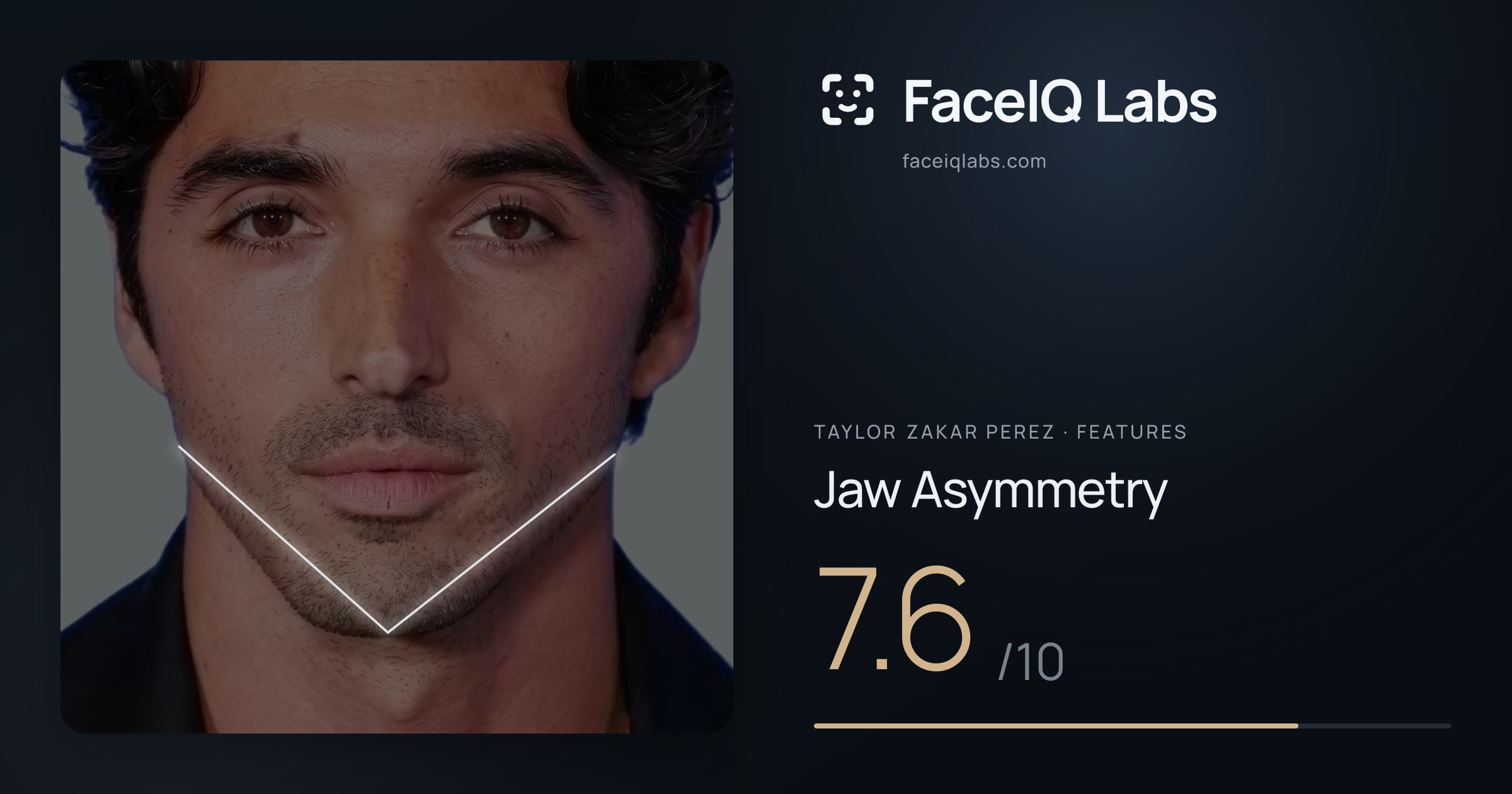 Taylor Zakar Perez Jaw Asymmetry: 7.6/10, drawn on the photo