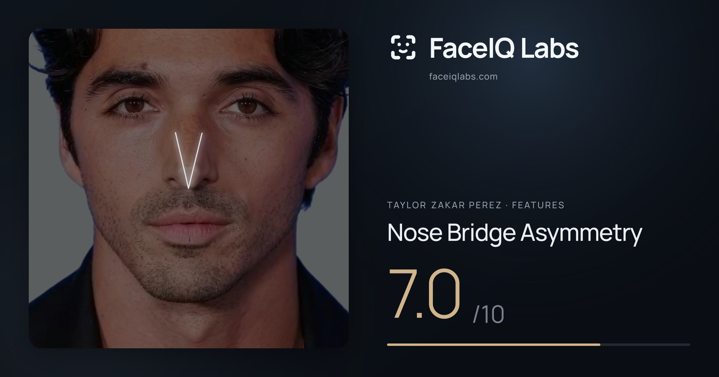 Taylor Zakar Perez Nose Bridge Asymmetry: 7.0/10, drawn on the photo