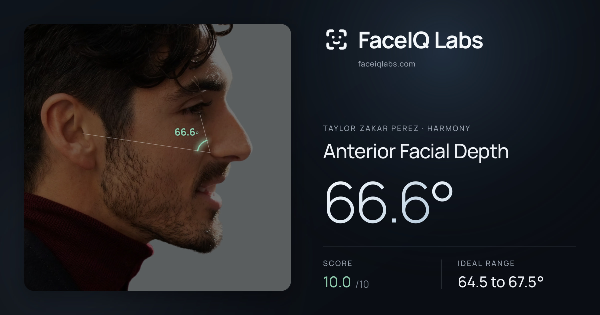 Taylor Zakar Perez Anterior Facial Depth: 66.6°, drawn on the photo