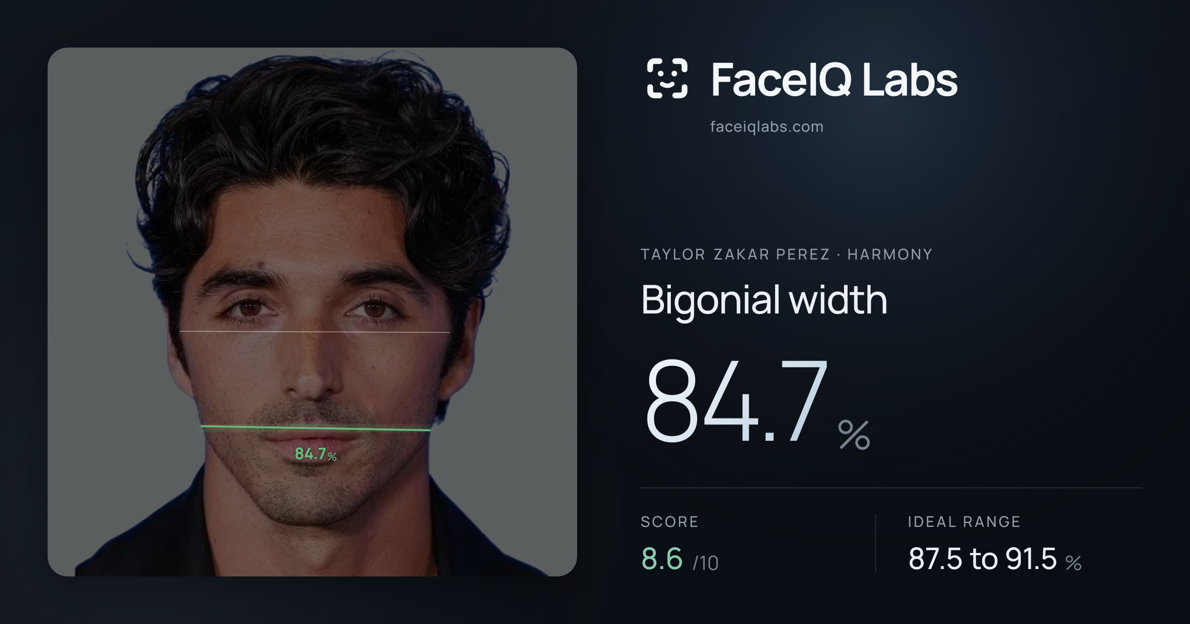 Taylor Zakar Perez Bigonial width: 84.7%, drawn on the photo