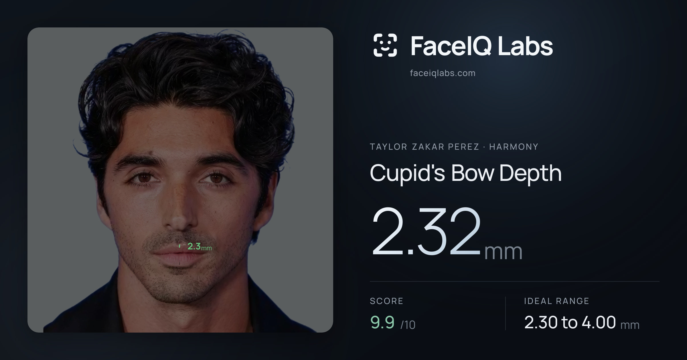 Taylor Zakar Perez Cupid's Bow Depth: 2.32mm, drawn on the photo