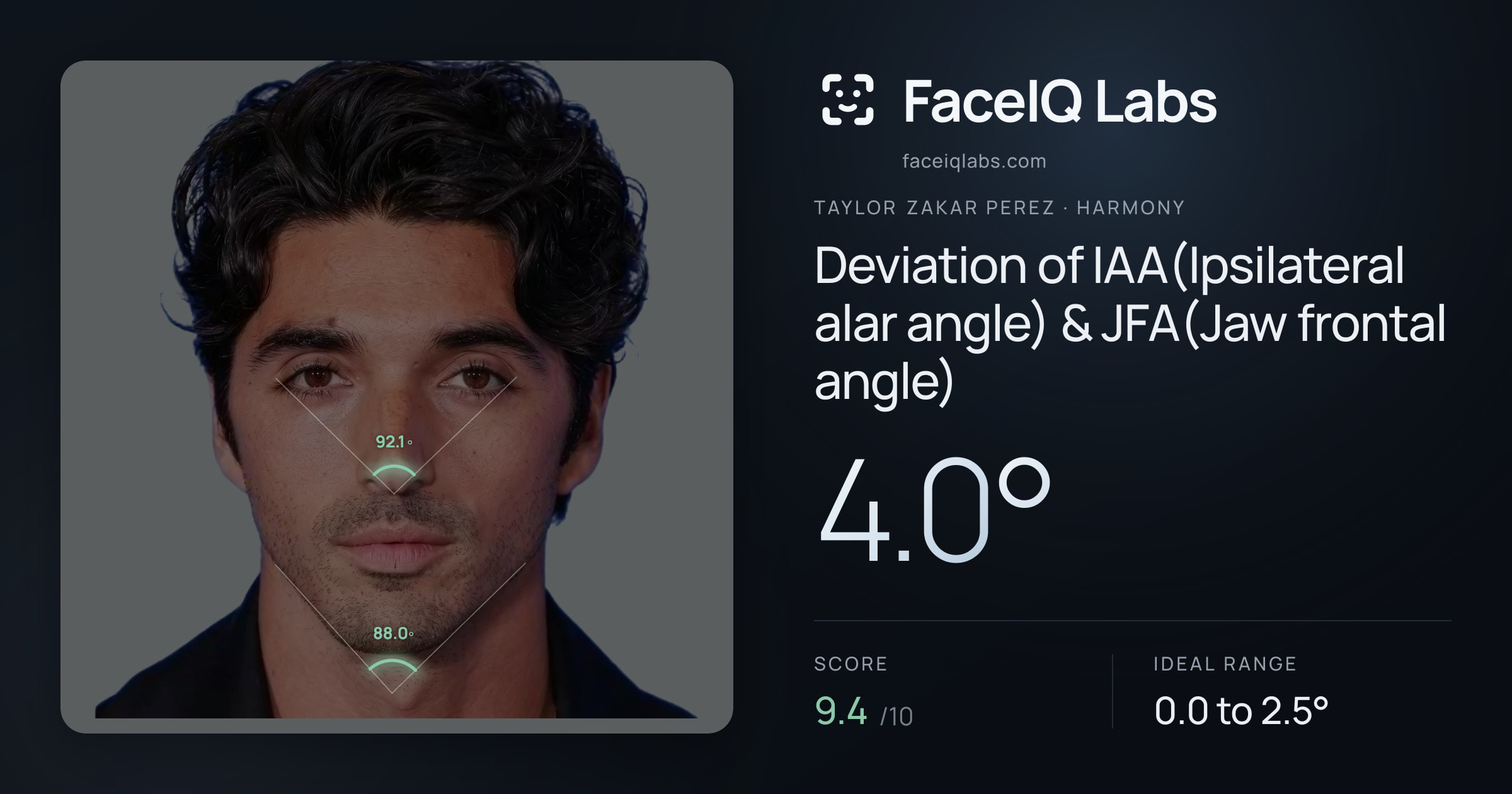 Taylor Zakar Perez Deviation of IAA(Ipsilateral alar angle) & JFA(Jaw frontal angle): 4.0°, drawn on the photo