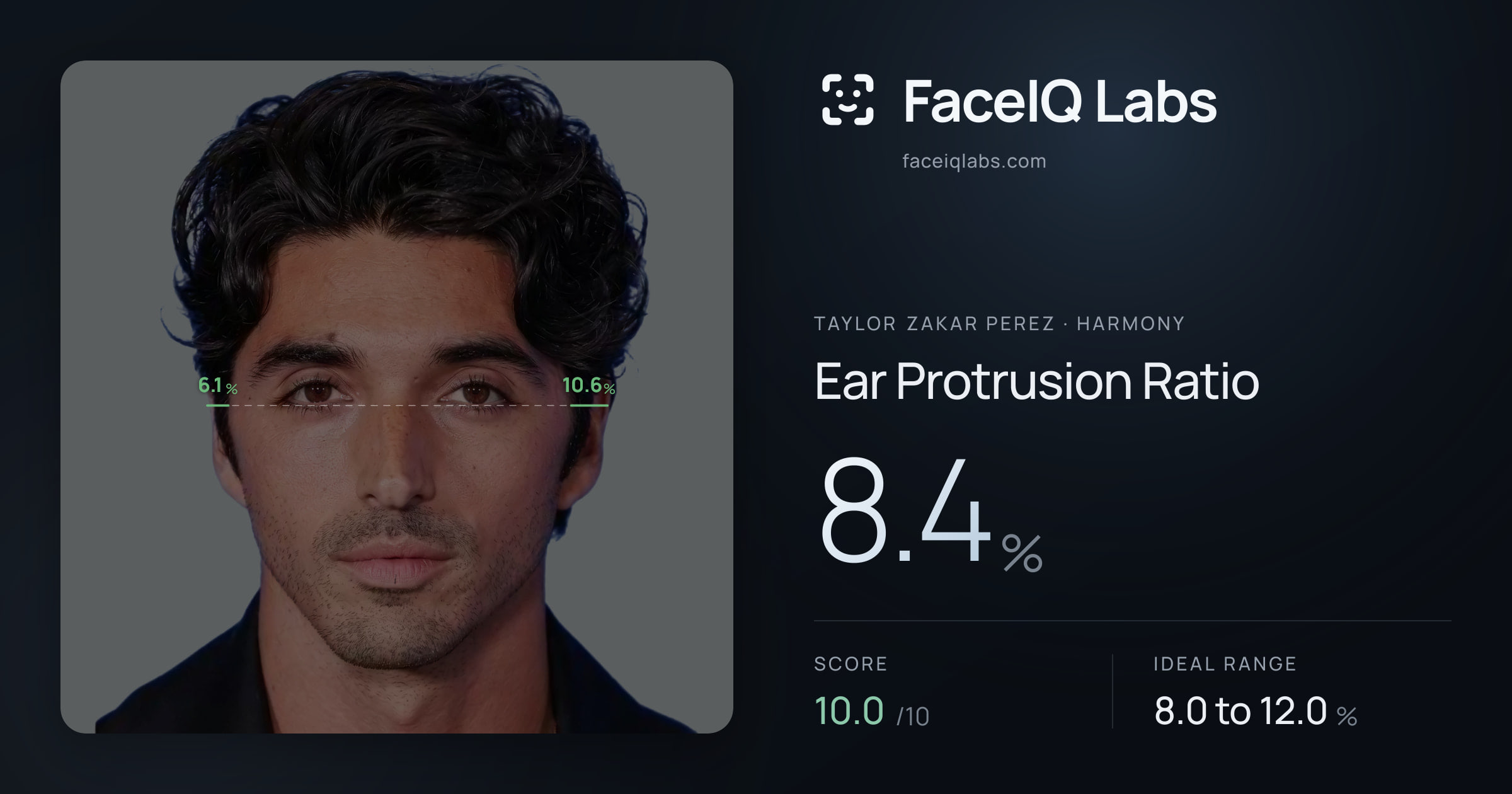 Taylor Zakar Perez Ear Protrusion Ratio: 8.4%, drawn on the photo