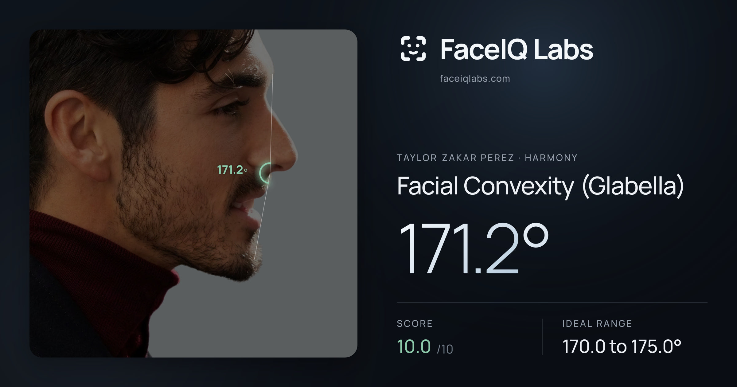 Taylor Zakar Perez Facial Convexity (Glabella): 171.2°, drawn on the photo