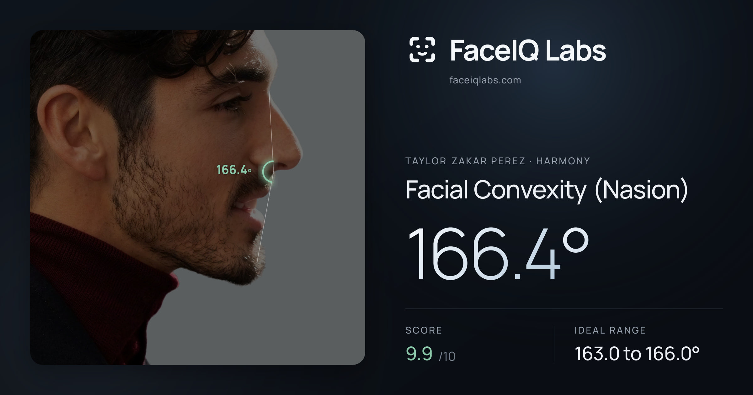 Taylor Zakar Perez Facial Convexity (Nasion): 166.4°, drawn on the photo