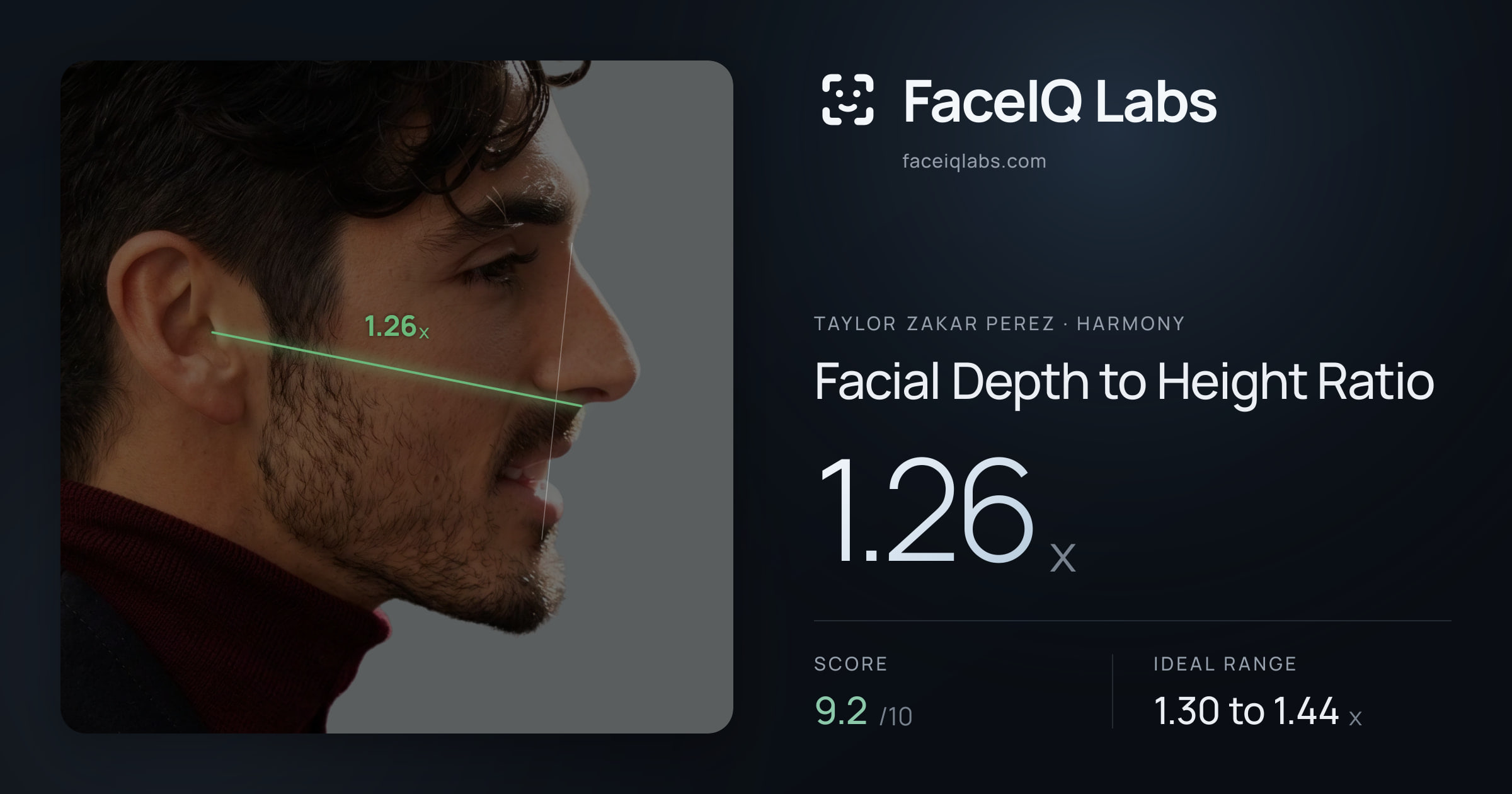 Taylor Zakar Perez Facial Depth to Height Ratio: 1.26x, drawn on the photo