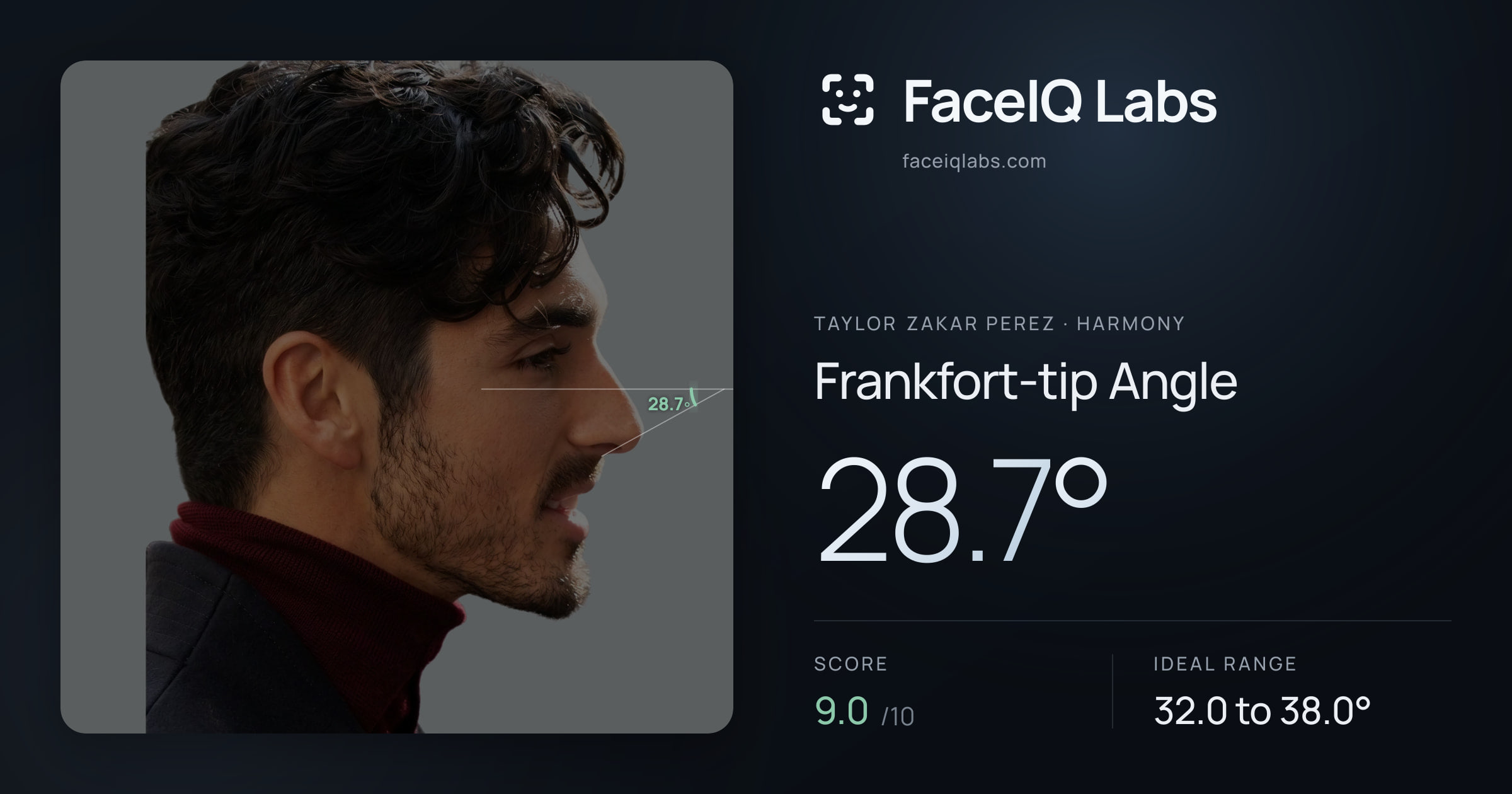 Taylor Zakar Perez Frankfort-tip Angle: 28.7°, drawn on the photo