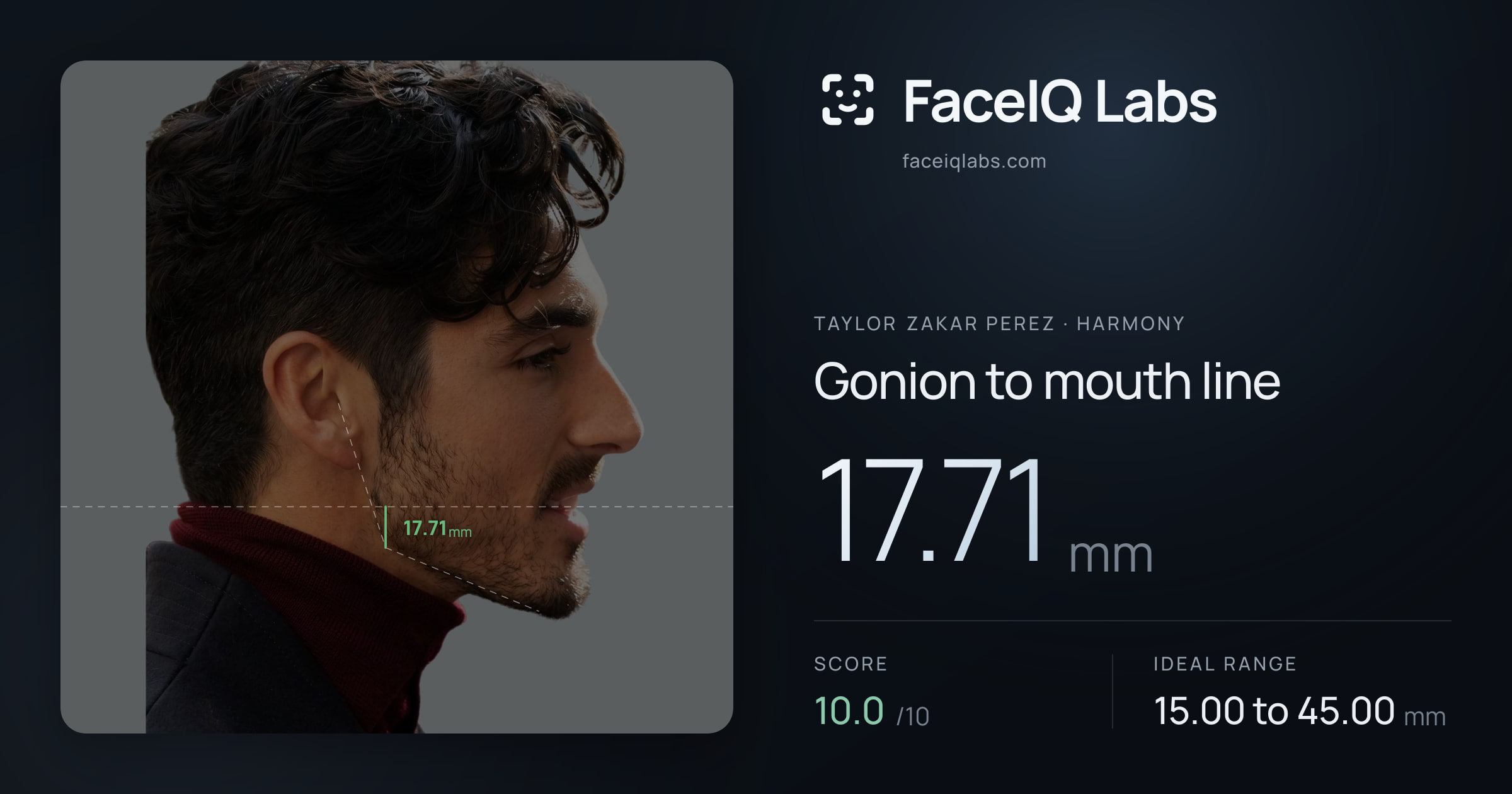 Taylor Zakar Perez Gonion to mouth line: 17.71mm, drawn on the photo