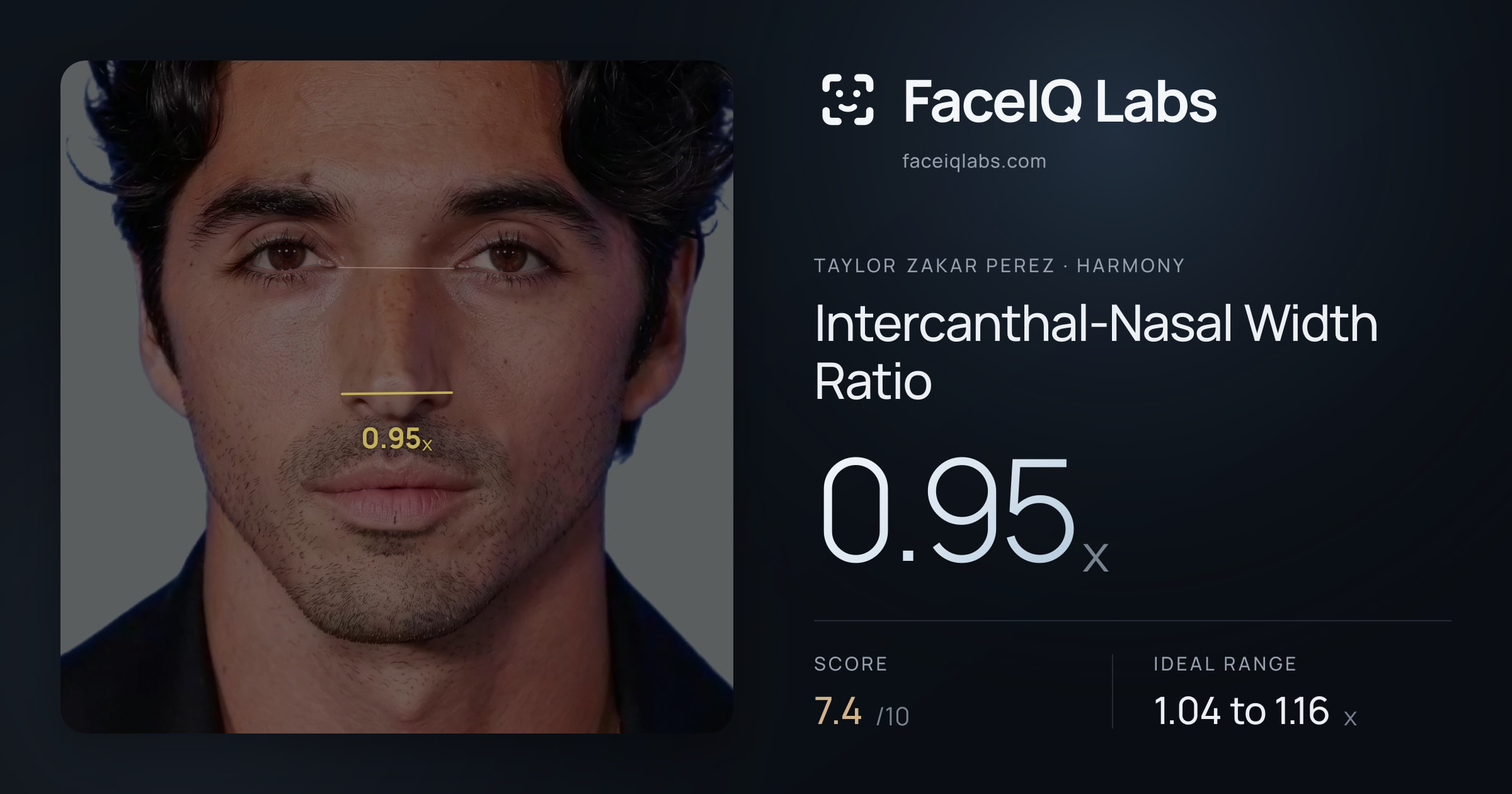 Taylor Zakar Perez Intercanthal-Nasal Width Ratio: 0.95x, drawn on the photo