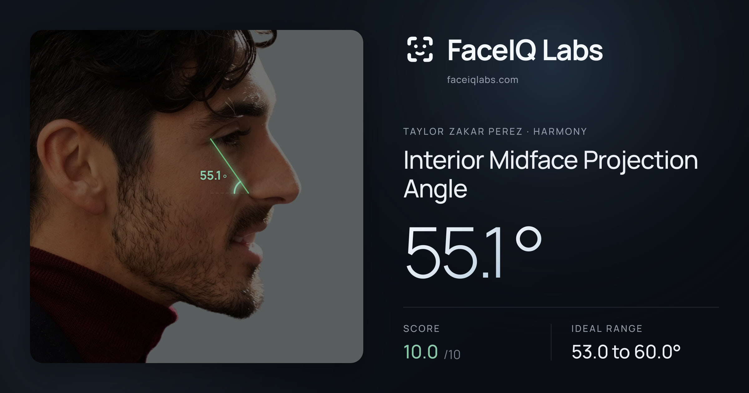 Taylor Zakar Perez Interior Midface Projection Angle: 55.1°, drawn on the photo