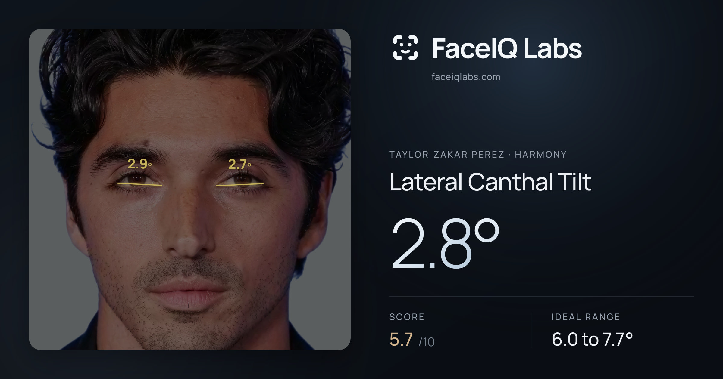 Taylor Zakar Perez Lateral Canthal Tilt: 2.8°, drawn on the photo