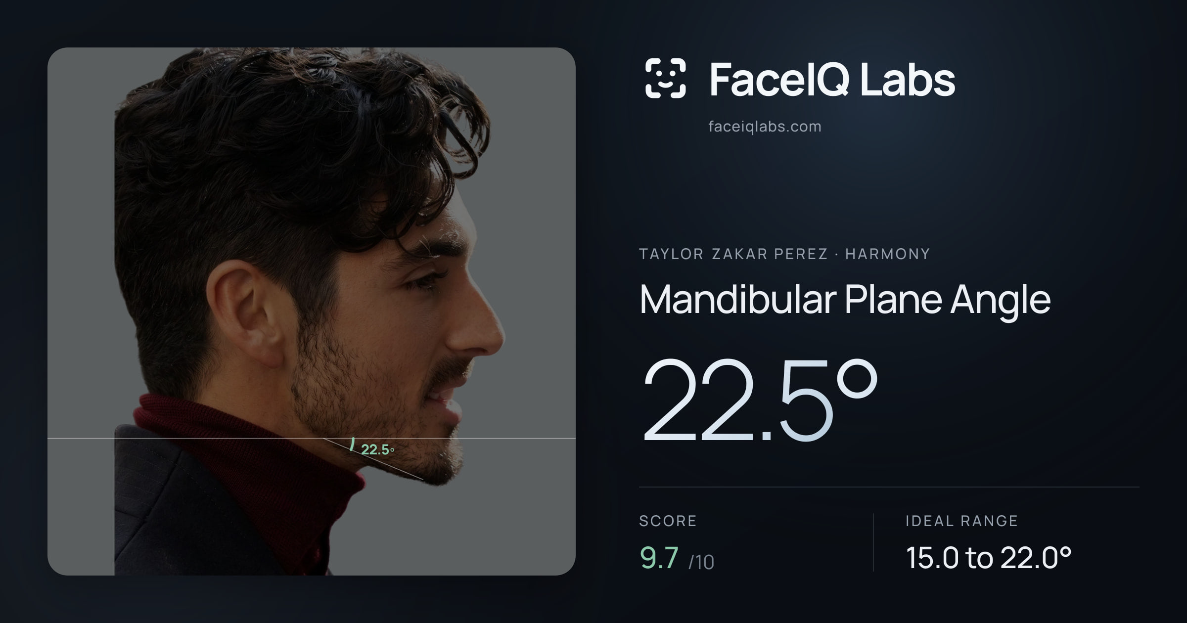 Taylor Zakar Perez Mandibular Plane Angle: 22.5°, drawn on the photo