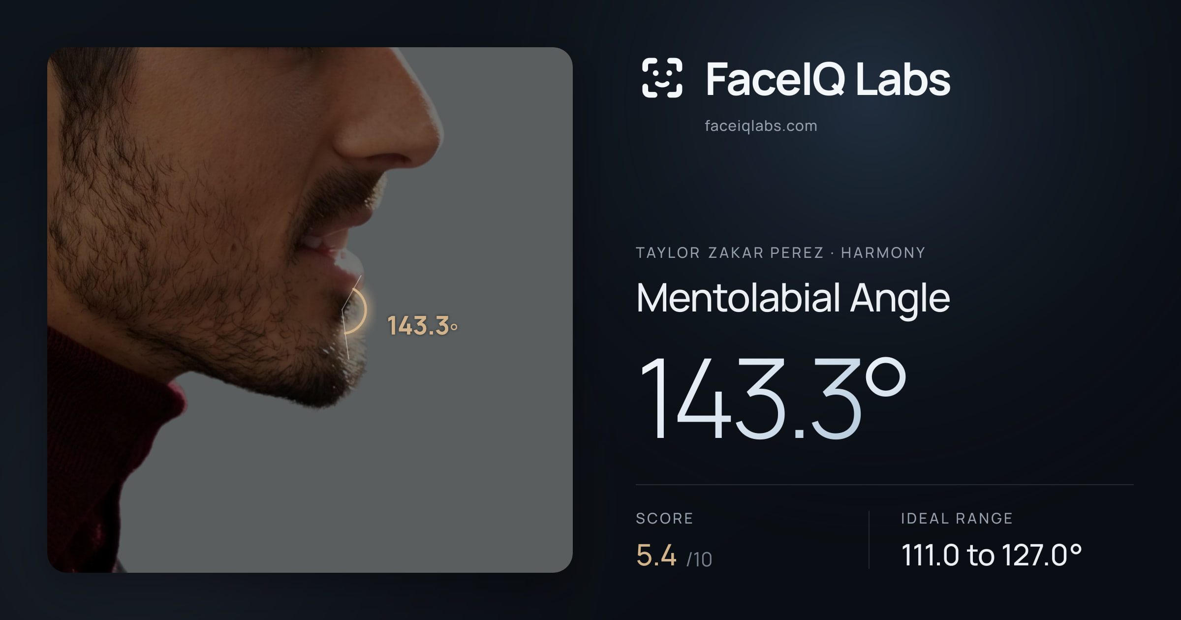 Taylor Zakar Perez Mentolabial Angle: 143.3°, drawn on the photo