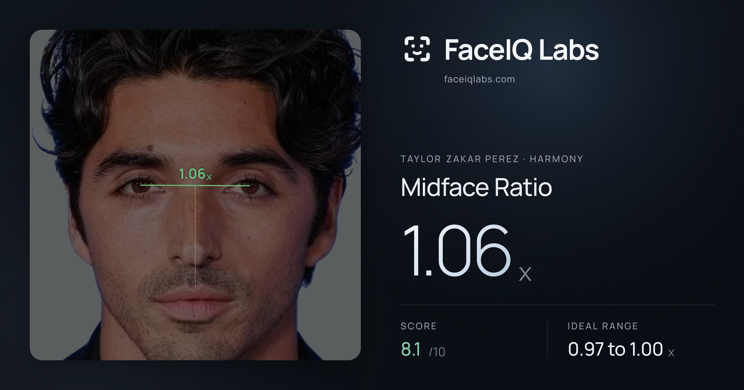Taylor Zakar Perez Midface Ratio: 1.06x, drawn on the photo