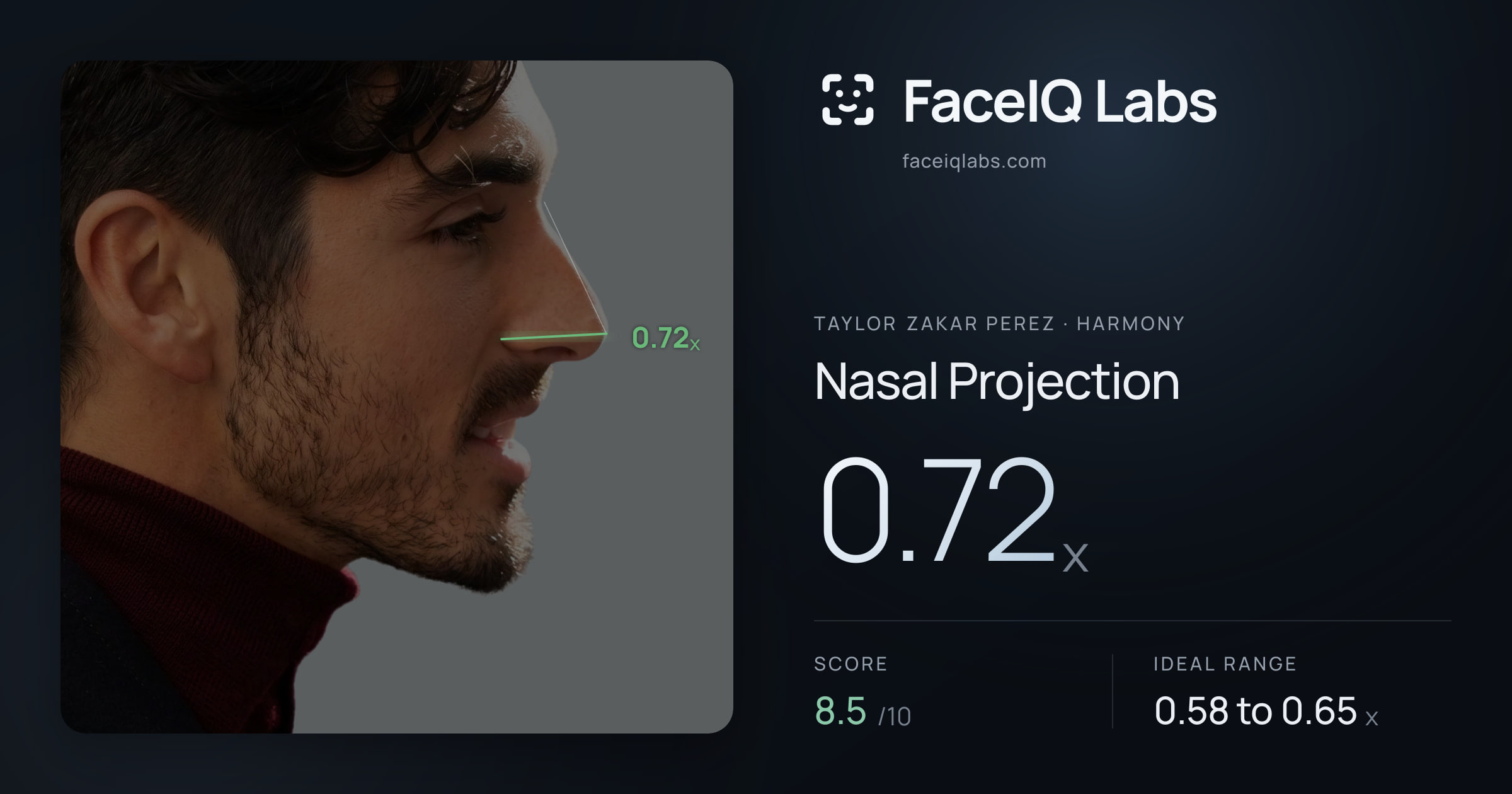 Taylor Zakar Perez Nasal Projection: 0.72x, drawn on the photo