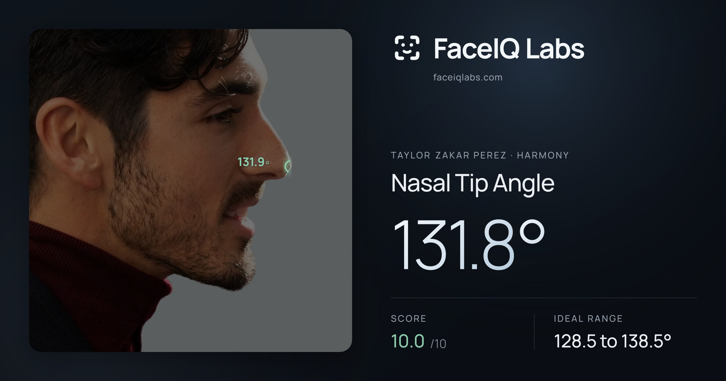 Taylor Zakar Perez Nasal Tip Angle: 131.8°, drawn on the photo