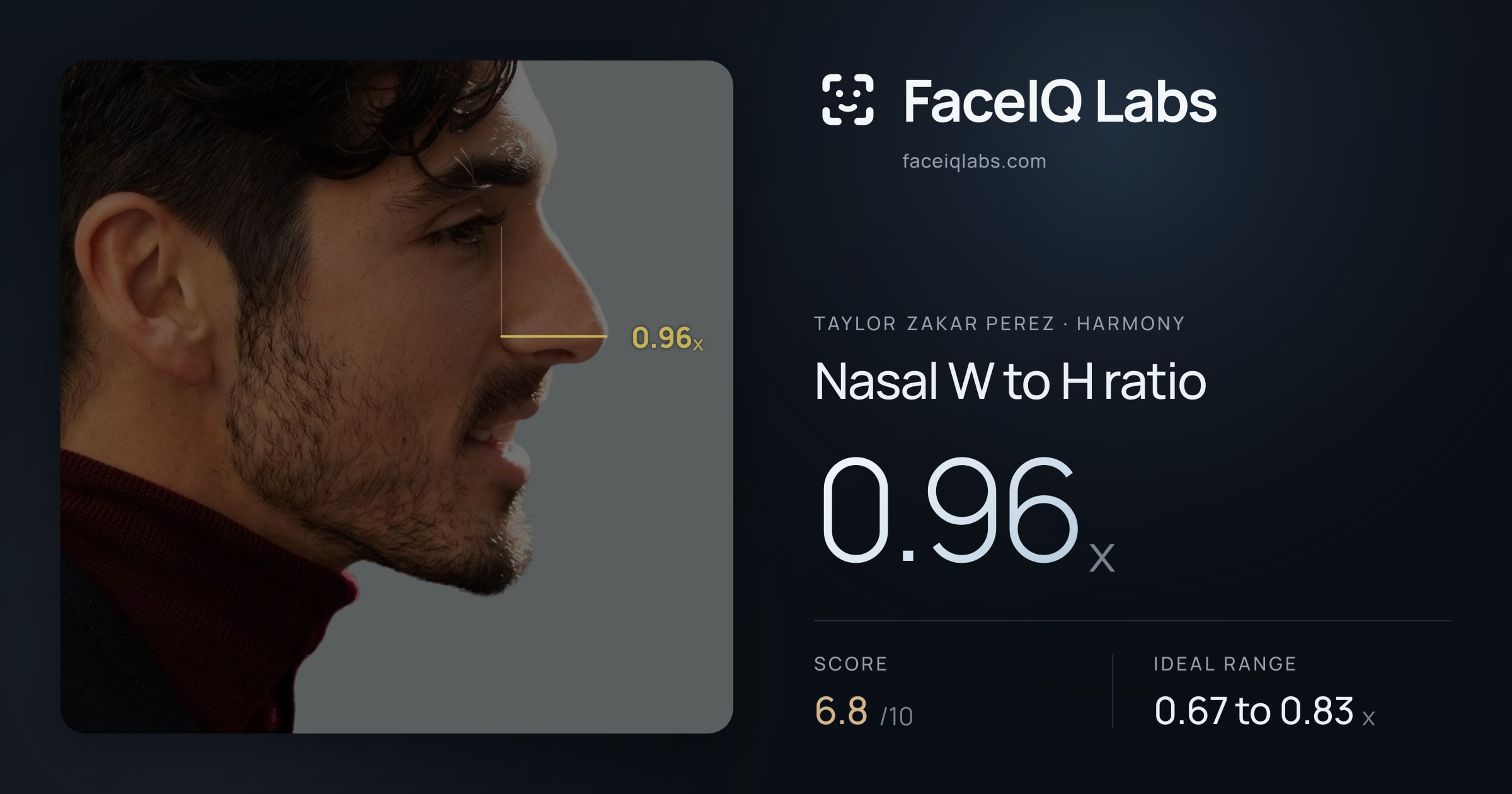 Taylor Zakar Perez Nasal W to H ratio: 0.96x, drawn on the photo