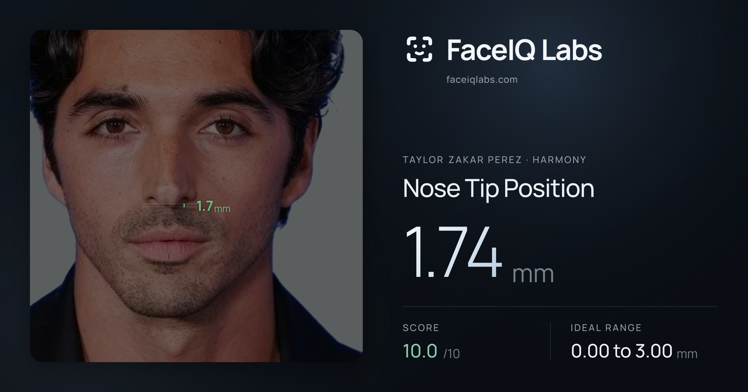 Taylor Zakar Perez Nose Tip Position: 1.74mm, drawn on the photo