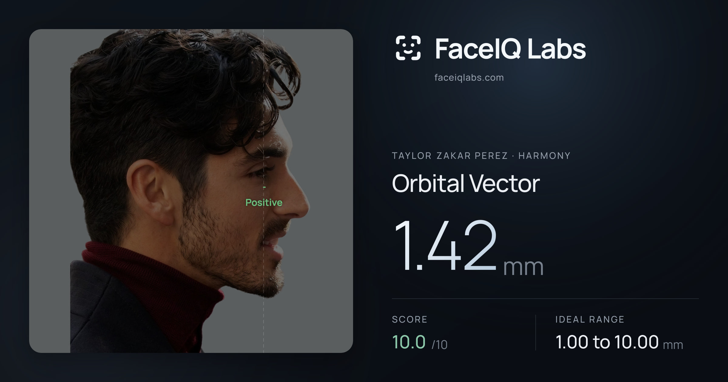 Taylor Zakar Perez Orbital Vector: 1.42mm, drawn on the photo