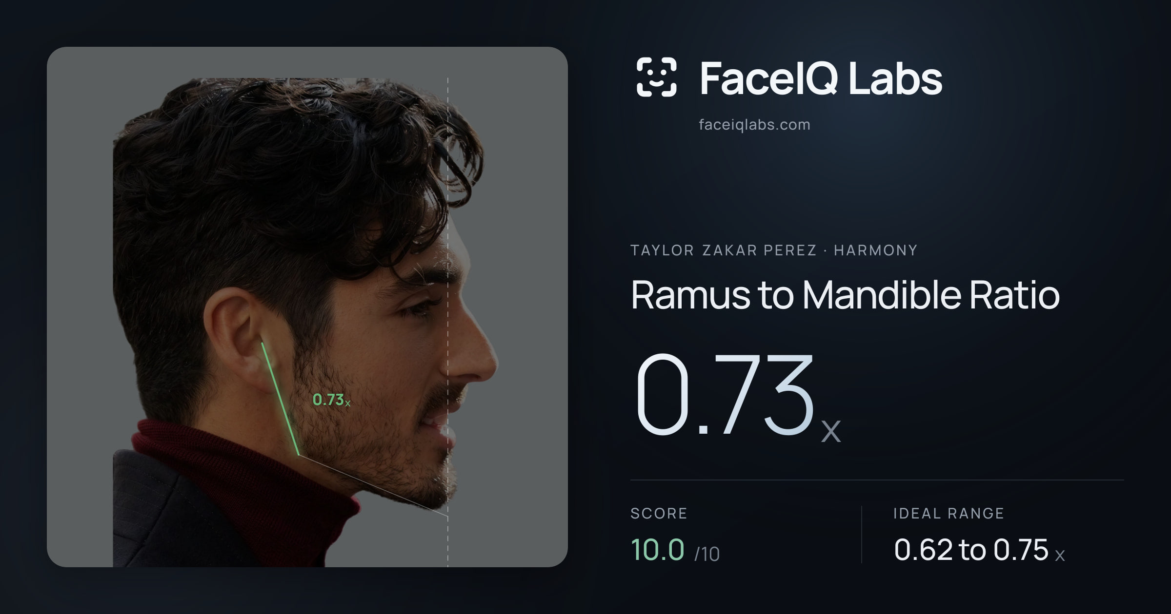 Taylor Zakar Perez Ramus to Mandible Ratio: 0.73x, drawn on the photo