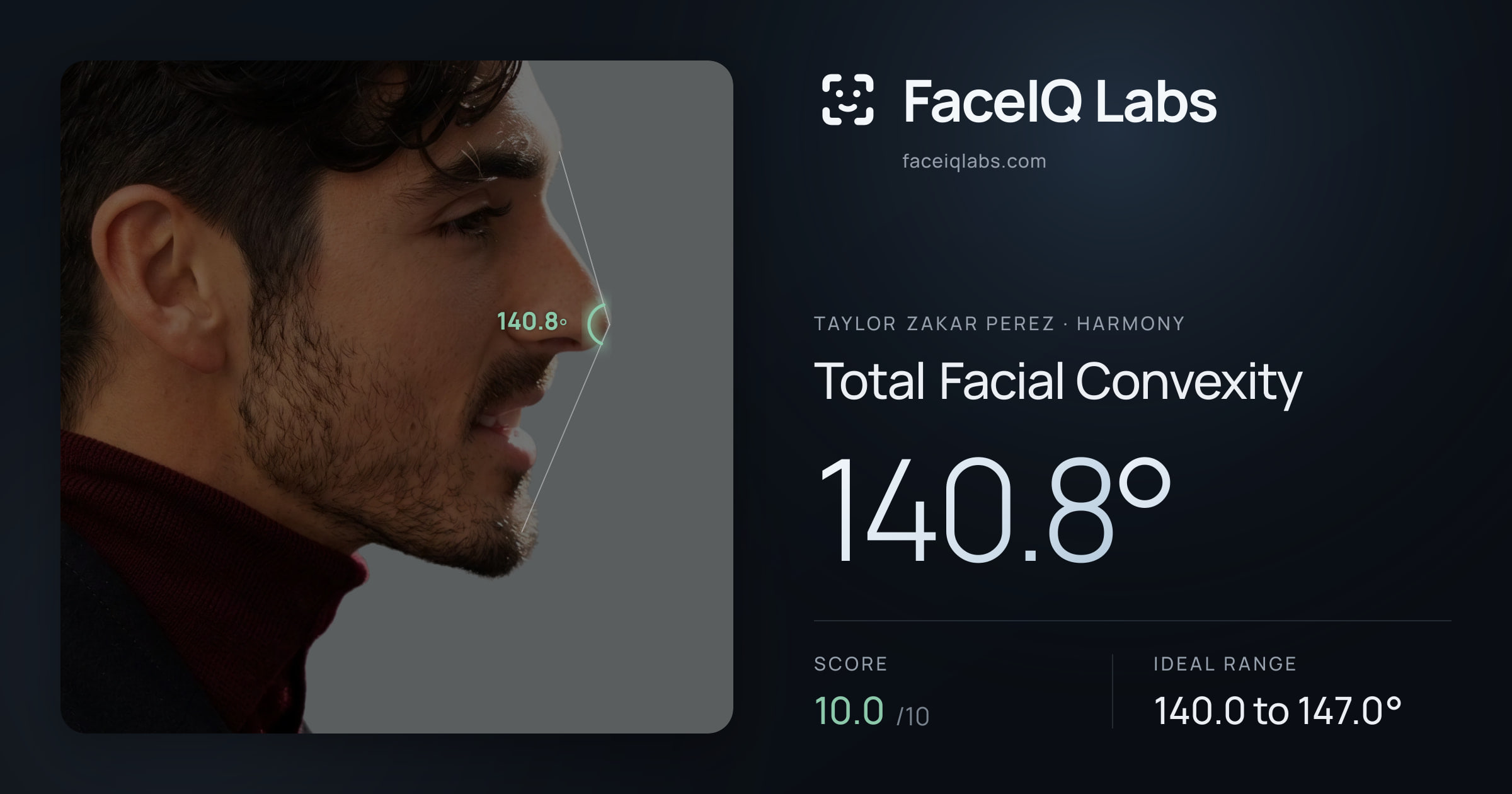 Taylor Zakar Perez Total Facial Convexity: 140.8°, drawn on the photo
